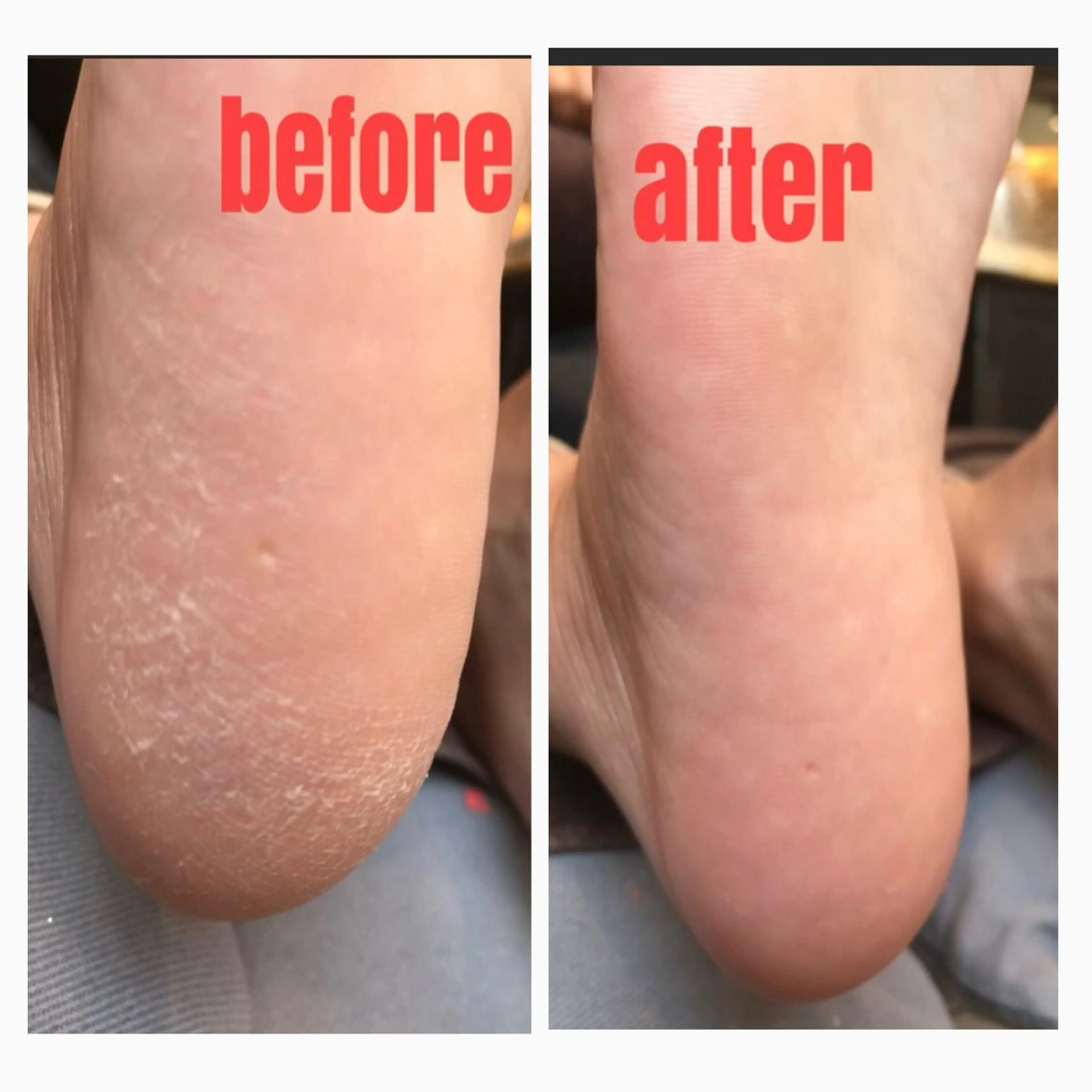 ネイル フットネイル 遠藤 未樹のネイルデザイン