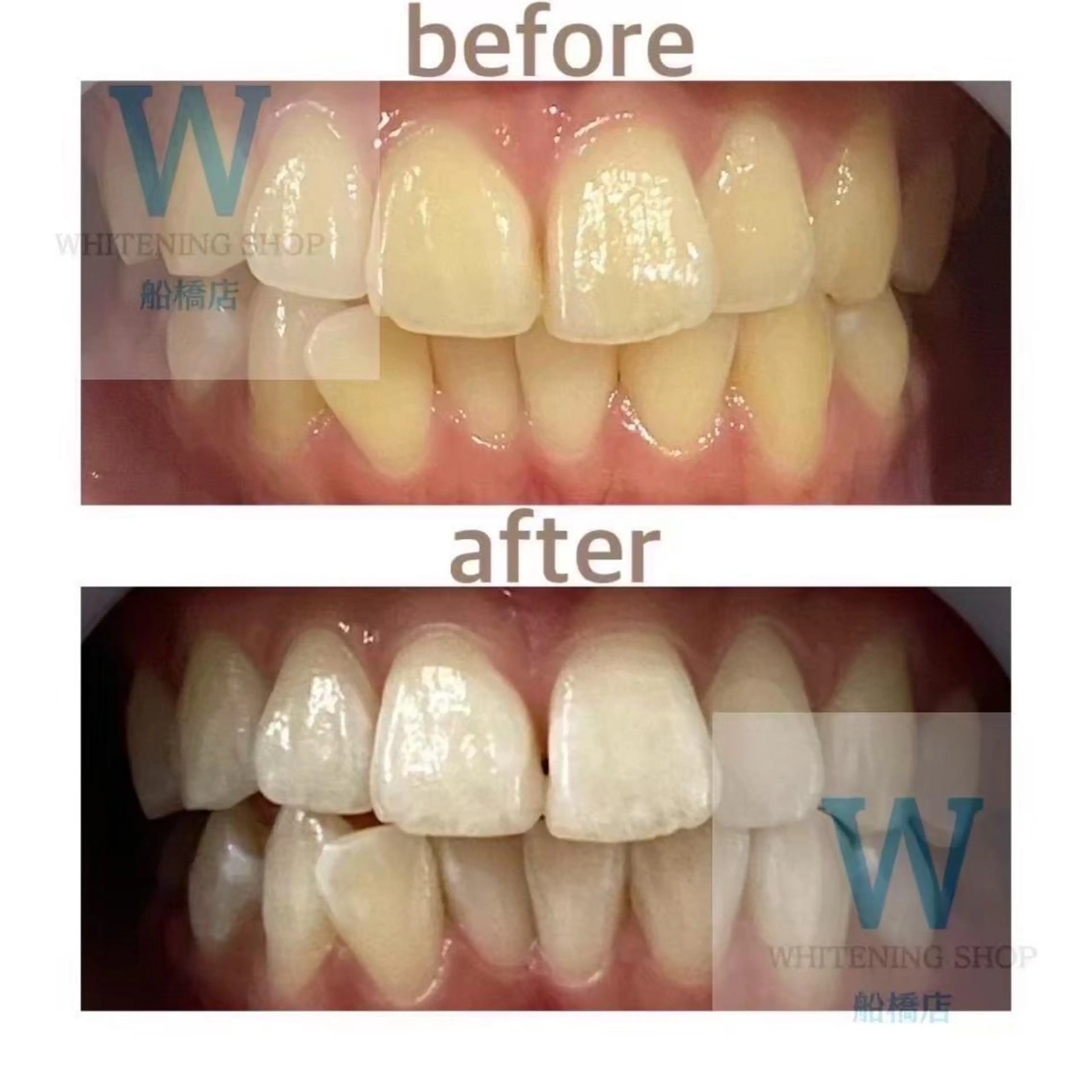 ホワイトニング ショップ船橋２号店のエステ・リラクイメージ