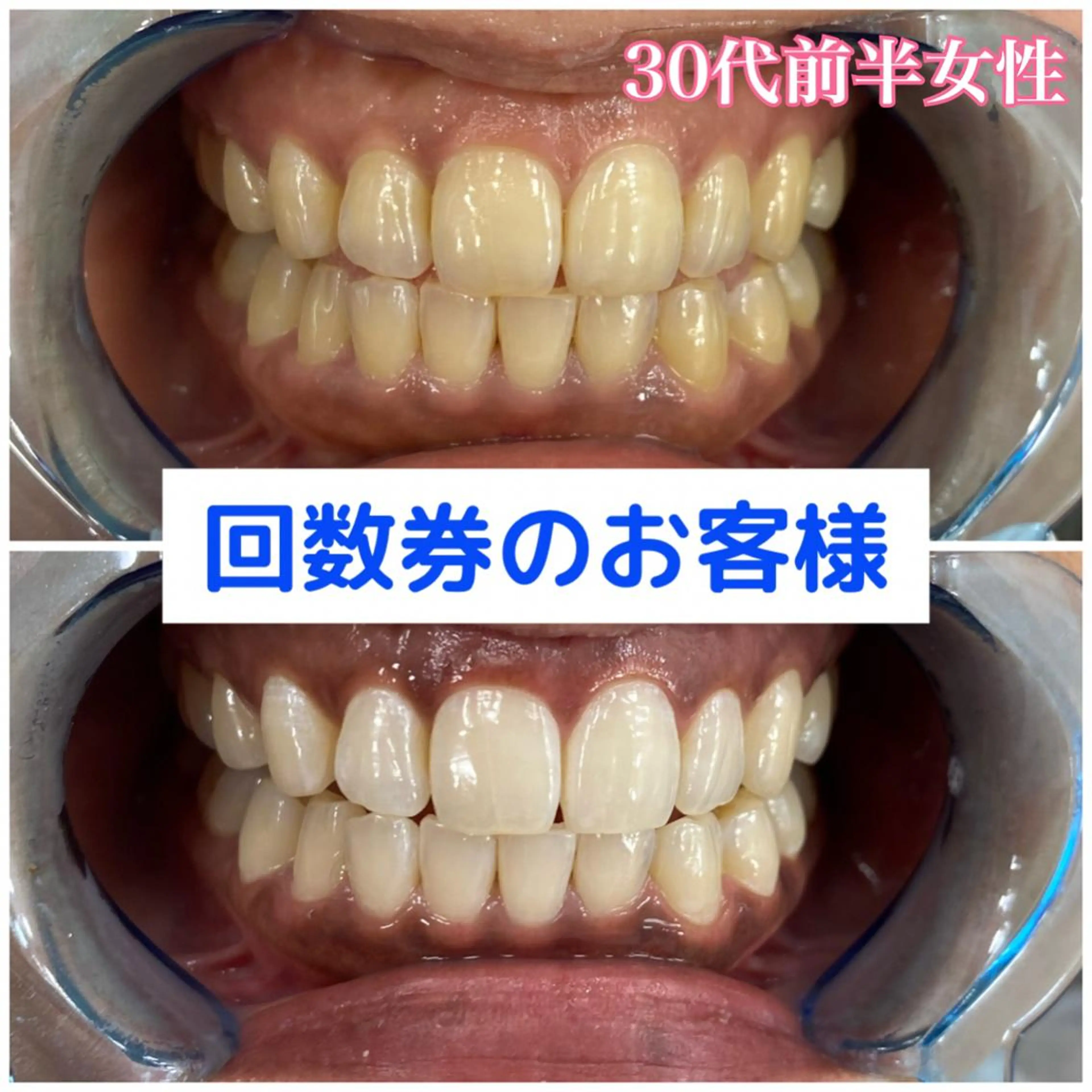 Platinum Beauty 四条烏丸店所属・吉田亮利 ホワイトニング専門店のその他イメージ