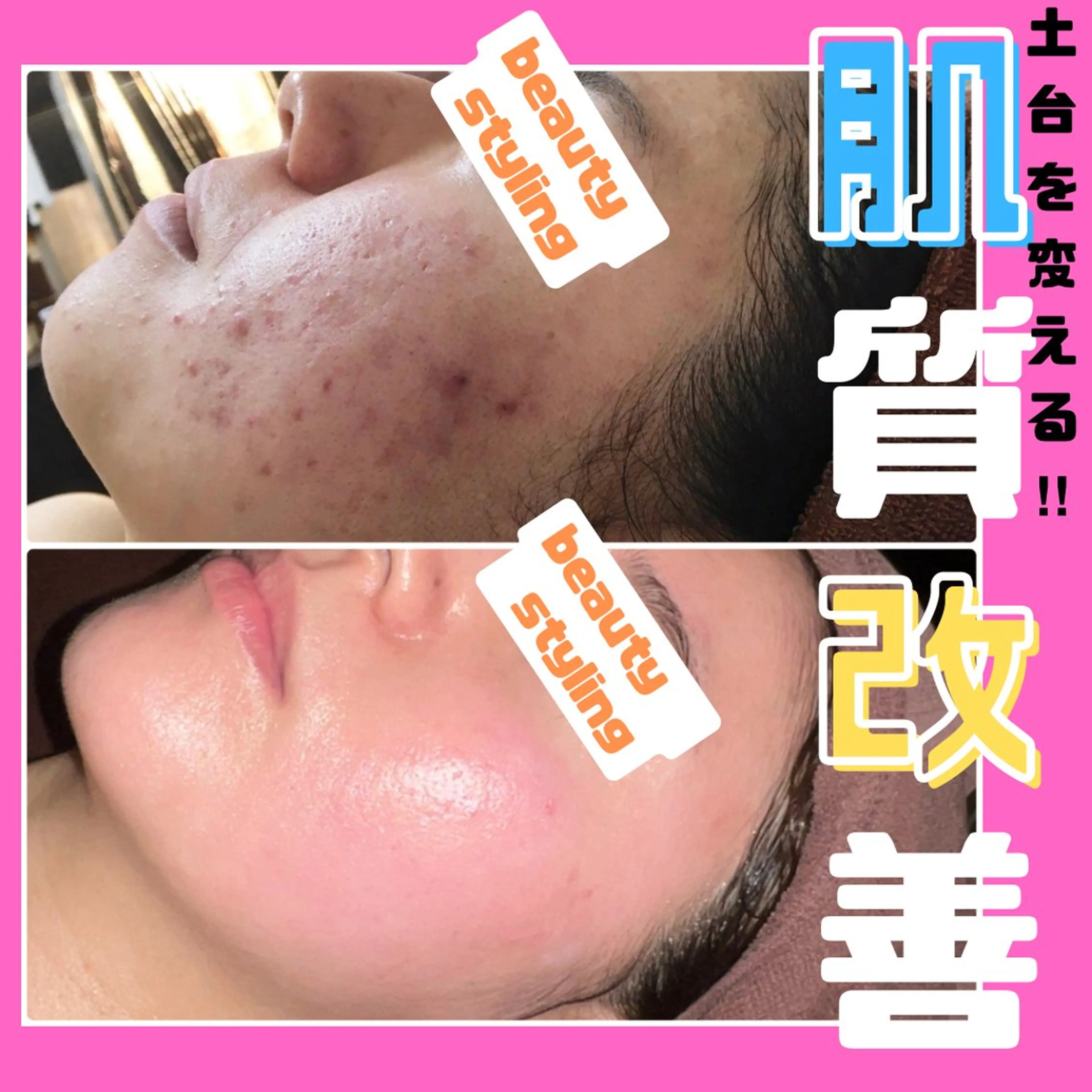 エステ リラク 痩身&美肌サロン 堀米✨のその他イメージ