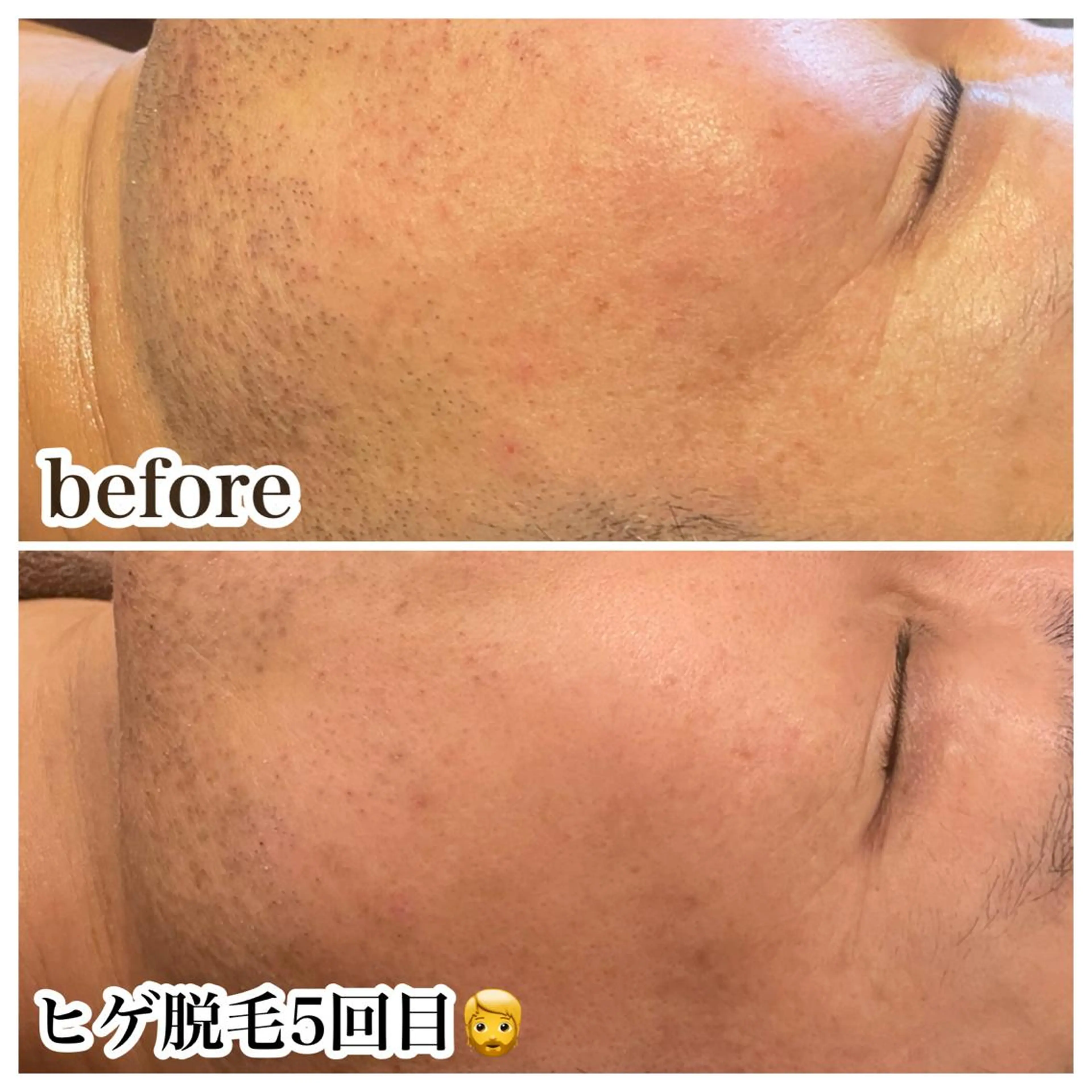 脱毛 浜野 恵美のエステ・リラクイメージ