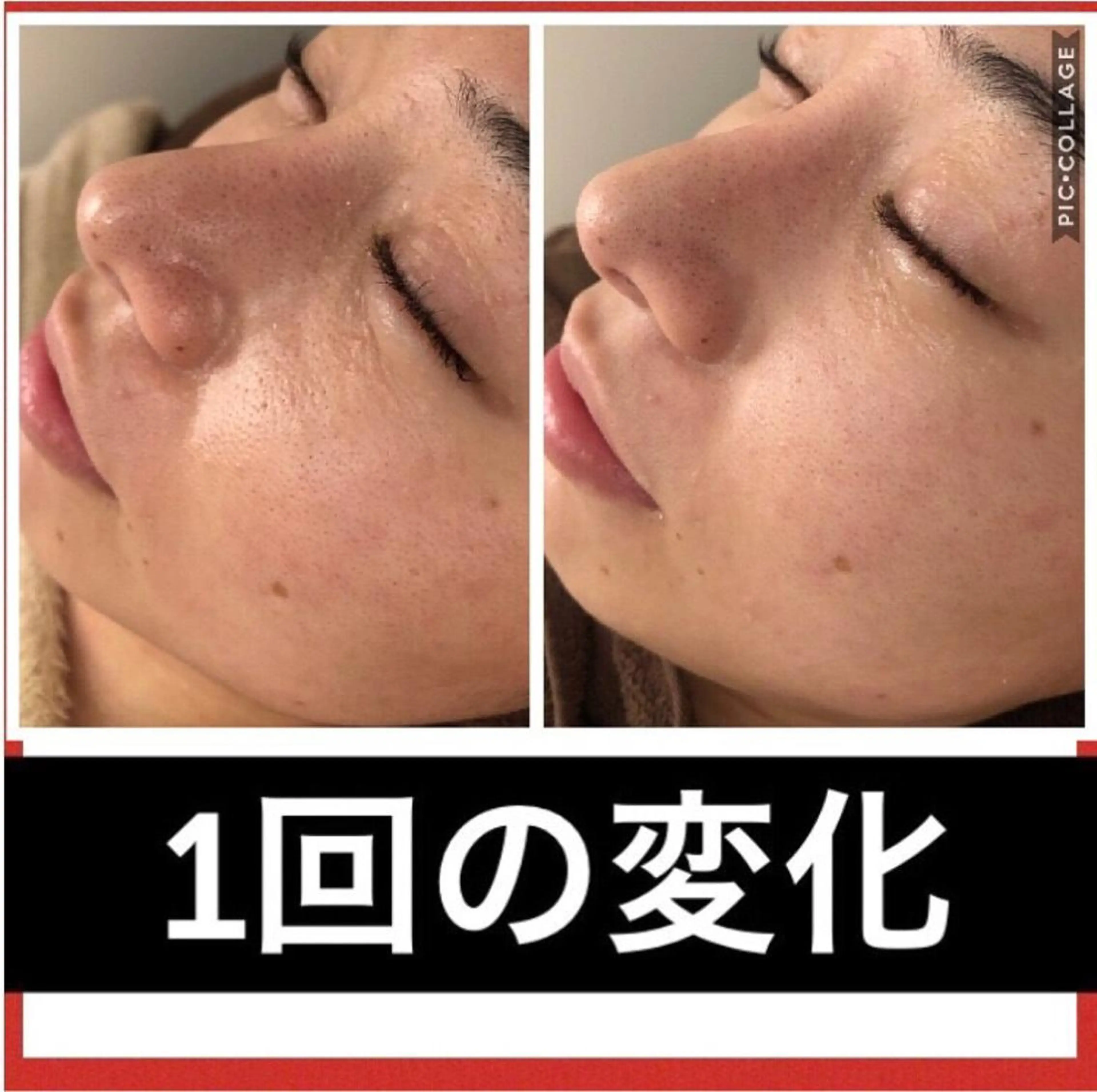 ミディアム パーマ ヘアアレンジ メンズ キッズ ネイル マツエク・マツパ ニキビ・肌質改善専門 ♡人生が変わるサロンのエステ・リラクイメージ