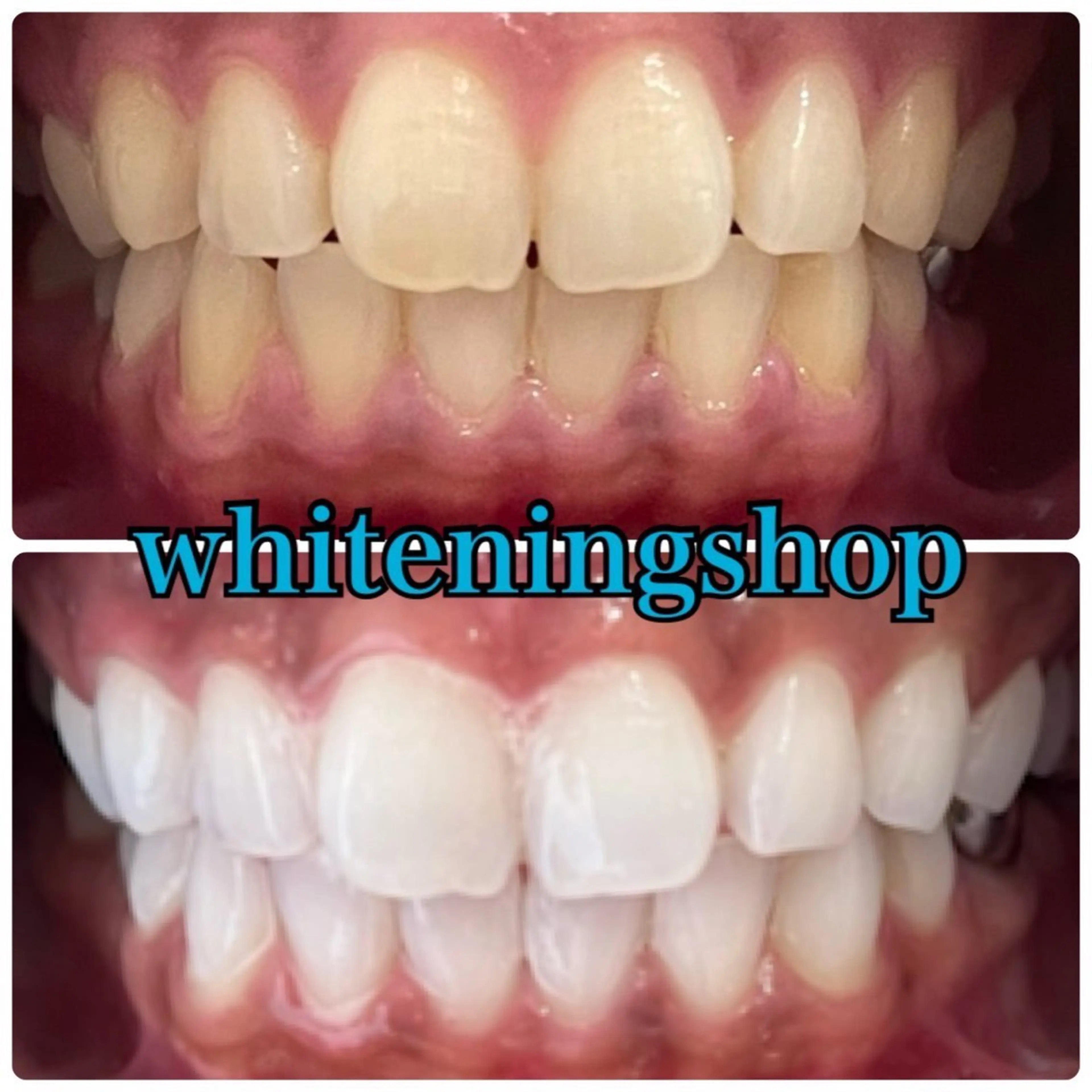 メンズ エステ リラク ホワイトニング ショップ川越店のエステ・リラクイメージ