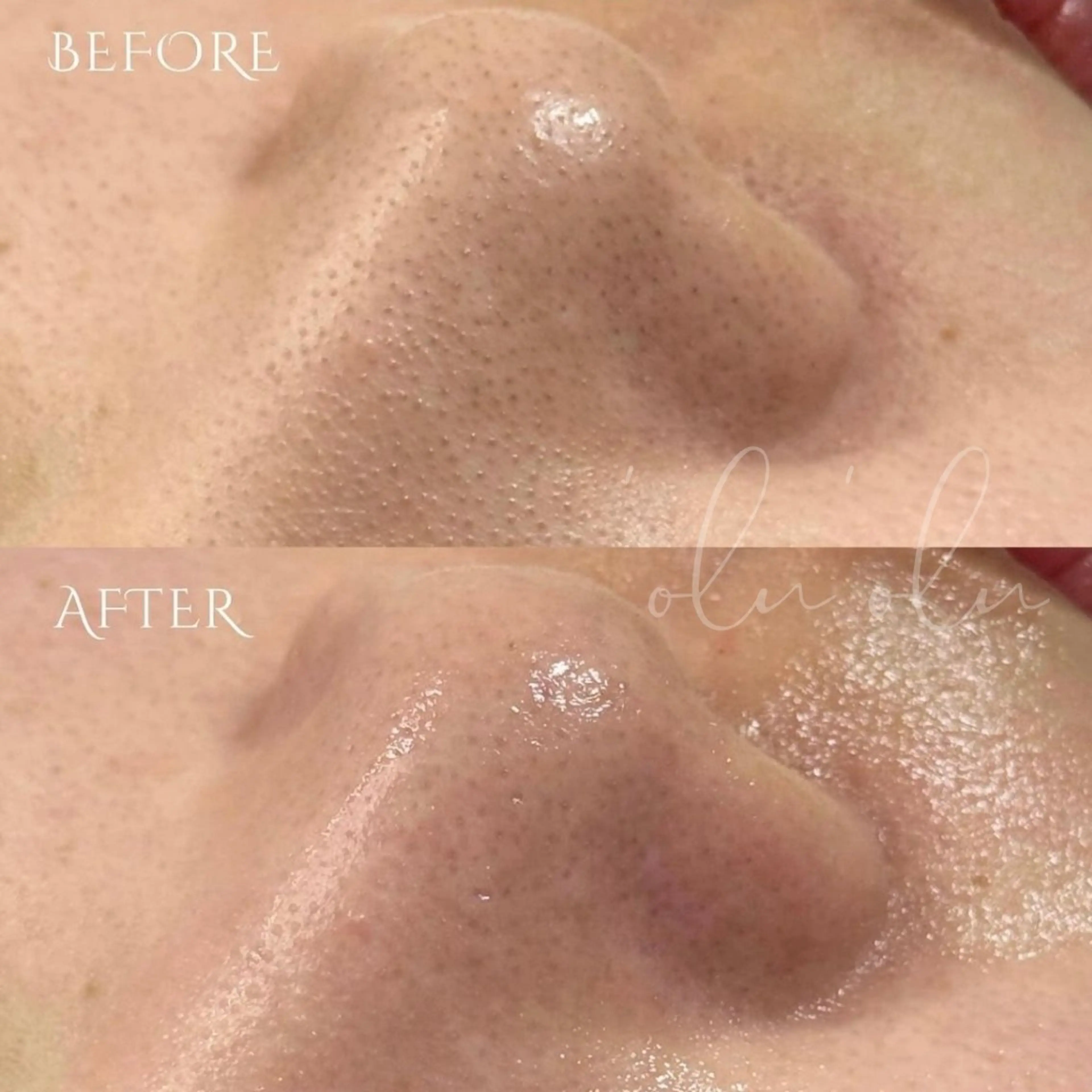 〈医療提携/毛穴・シミケア専門店〉 'Olu'Olu【オルオル】所属・'Olu'Olu シミ・毛穴専門サロンのエステ・リラクイメージ