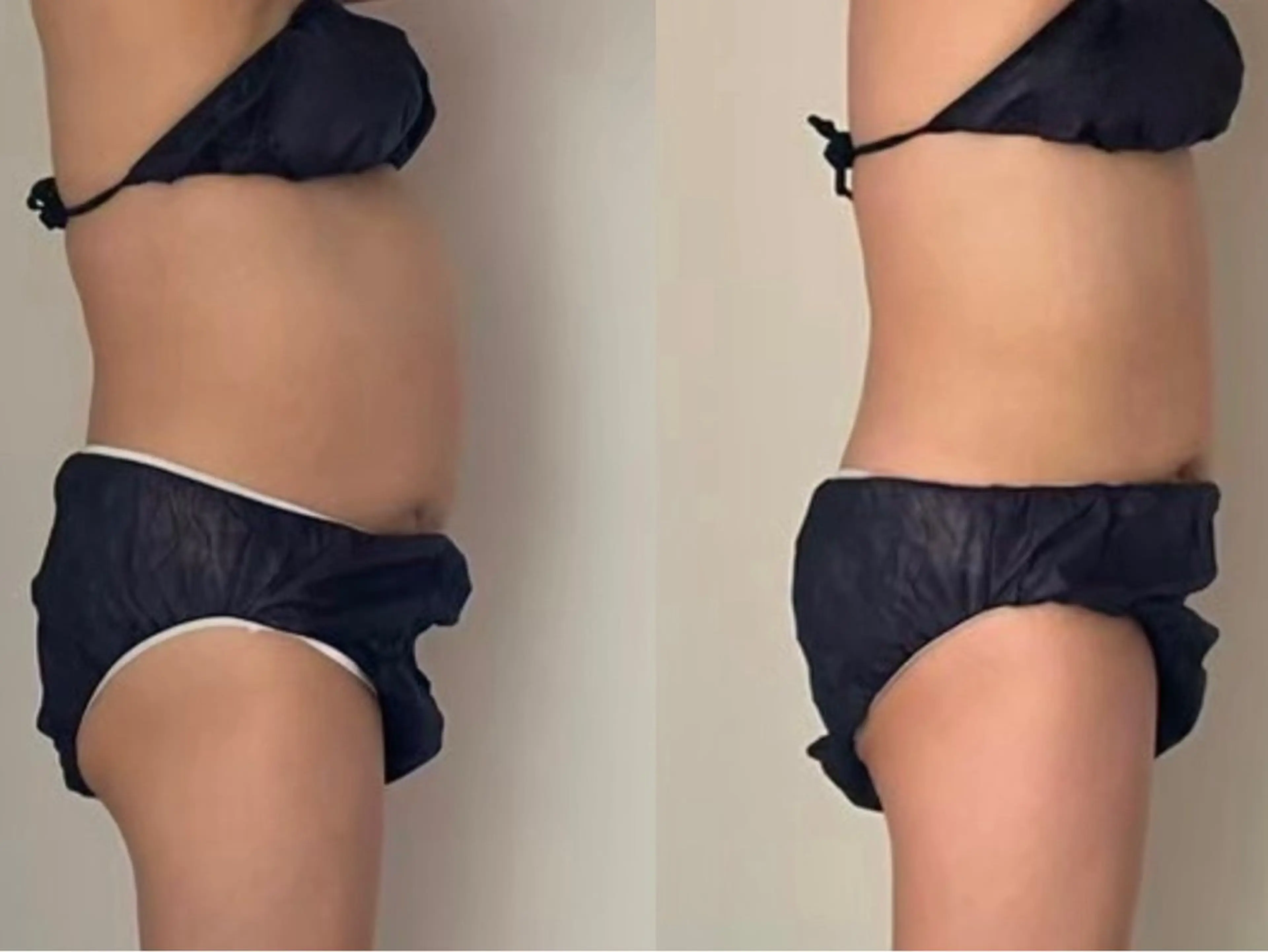 【冷え・むくみリセット】発汗温活×巡りケアの写真