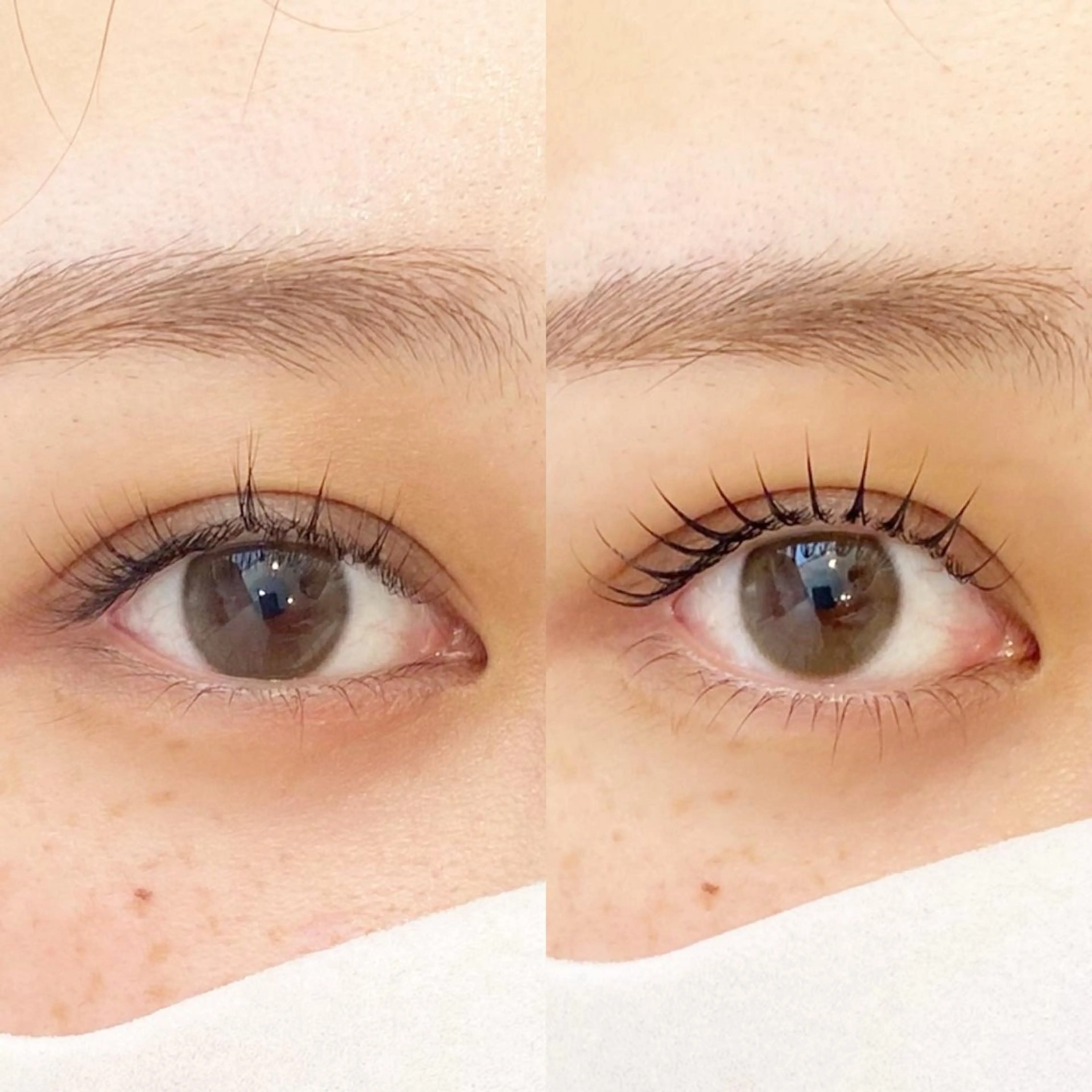 【ラッシュリフト上下】中顔面短縮/逆さまつげ解消の写真