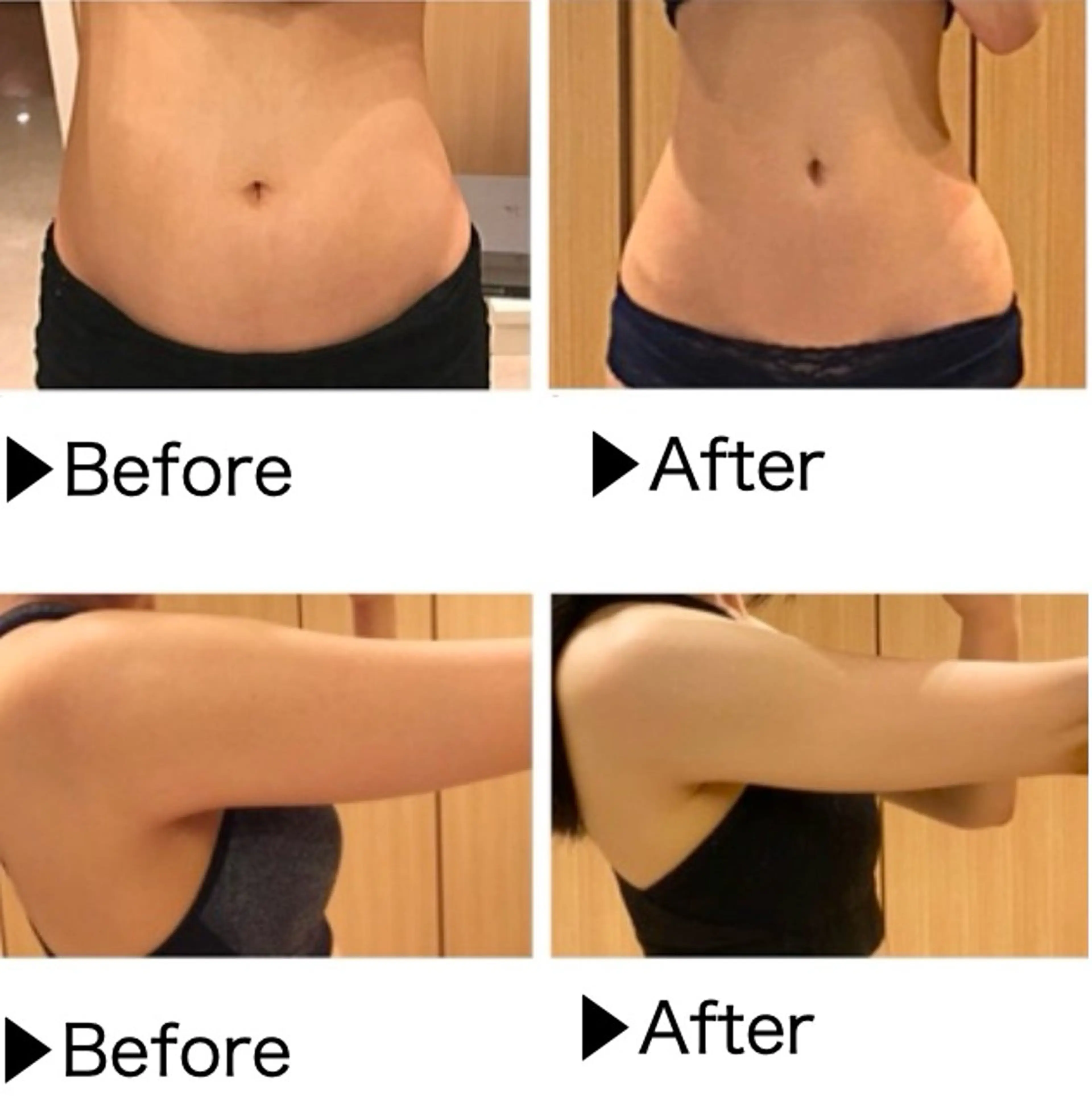 バストアップ・痩身 脱毛/🌺ｺｵﾘﾅのエステ・リラクイメージ