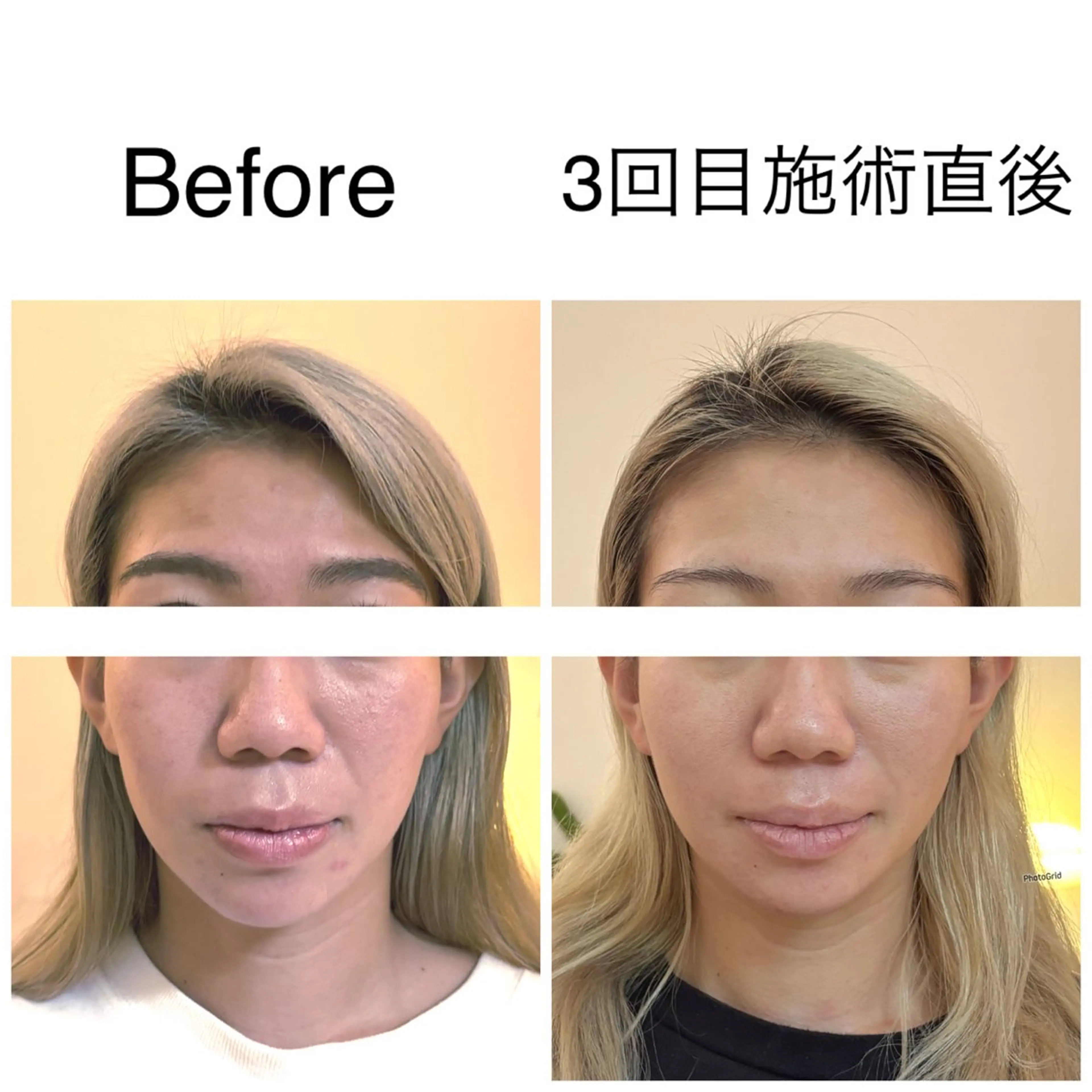 エステ リラク 小顔サロン Lehua-ﾚﾌｱ-のエステ・リラクイメージ