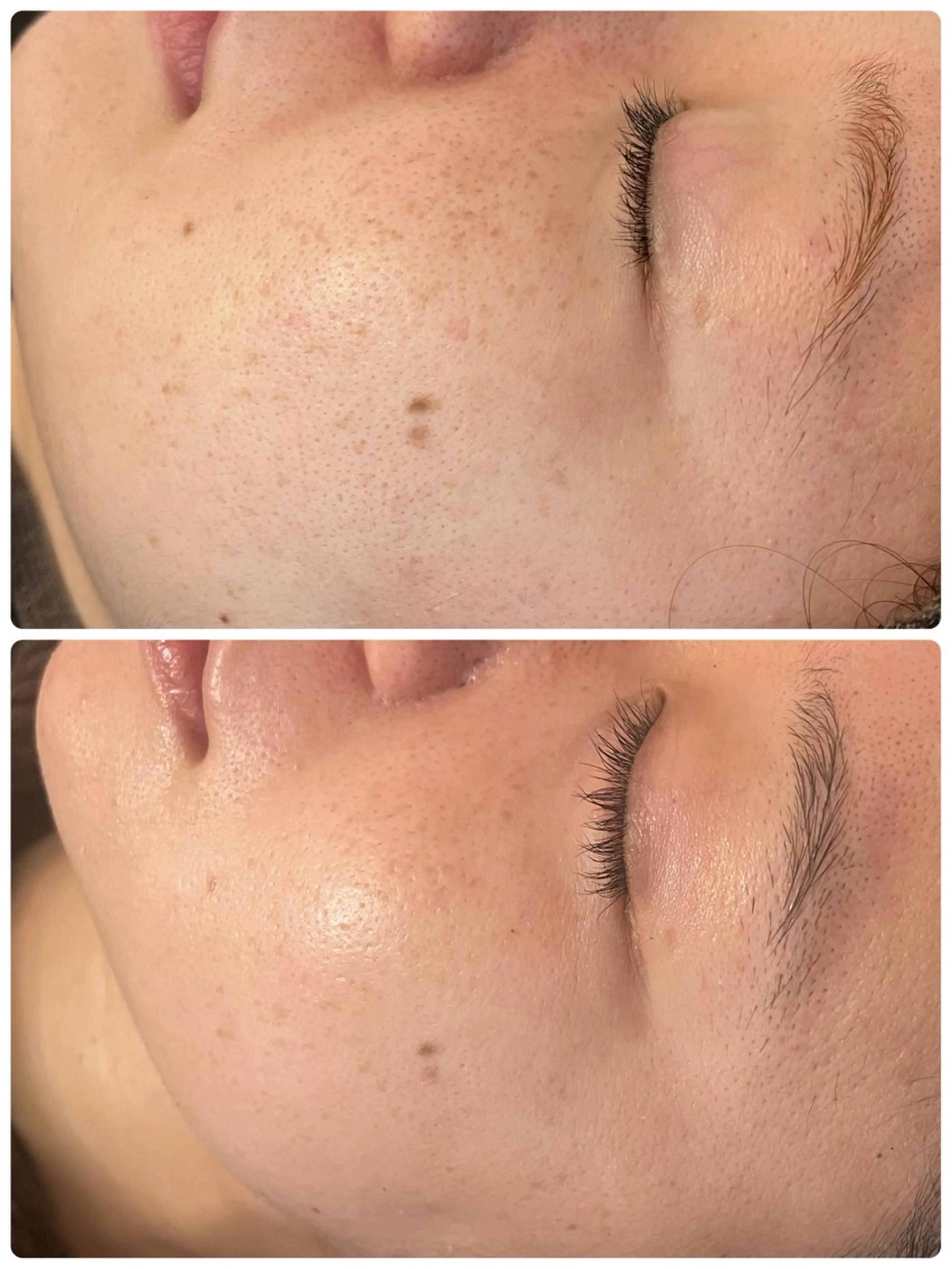 エステ kana ハーブピーリング🌿のエステ・リラクイメージ