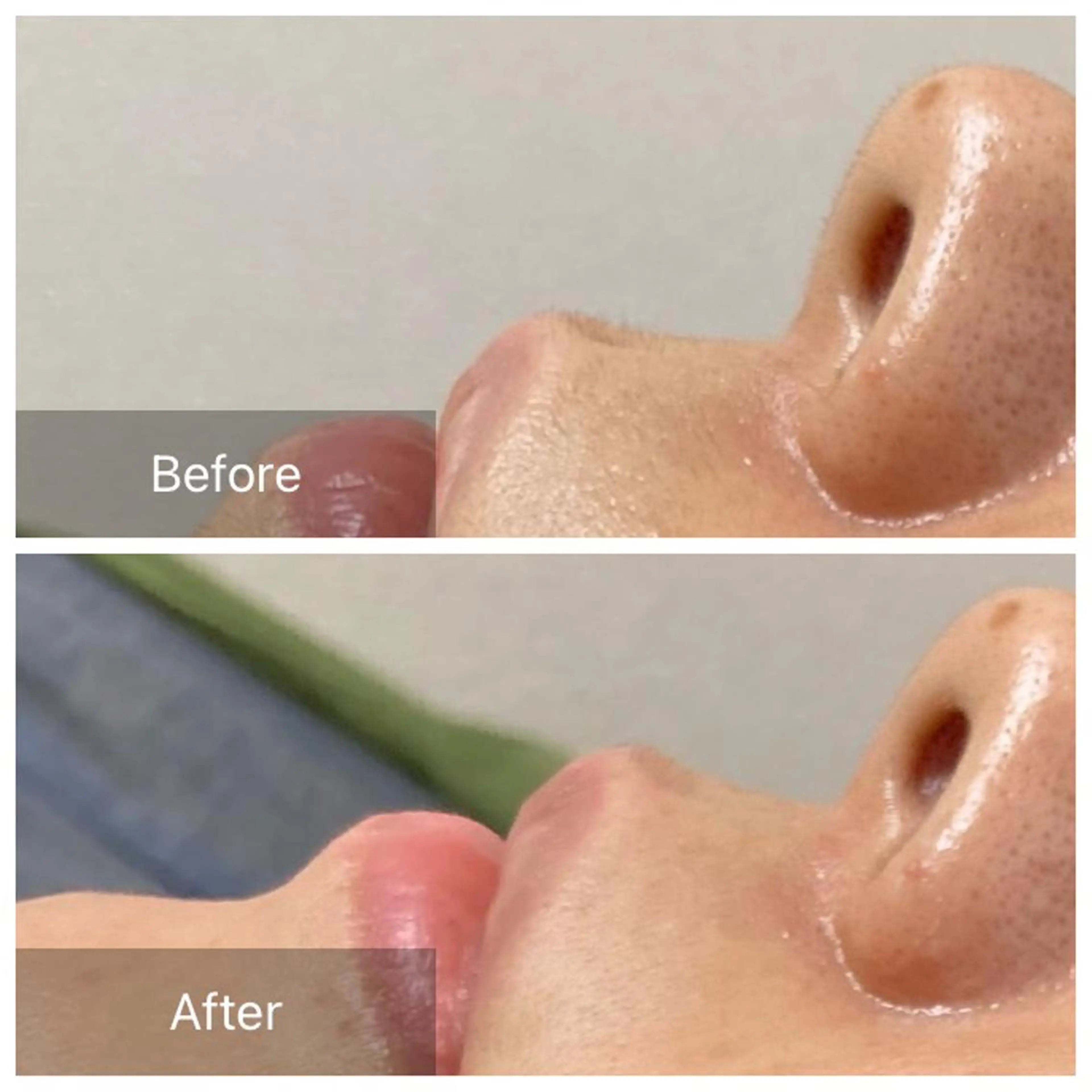 脱毛 産毛専門店 Bittoのエステ・リラクイメージ