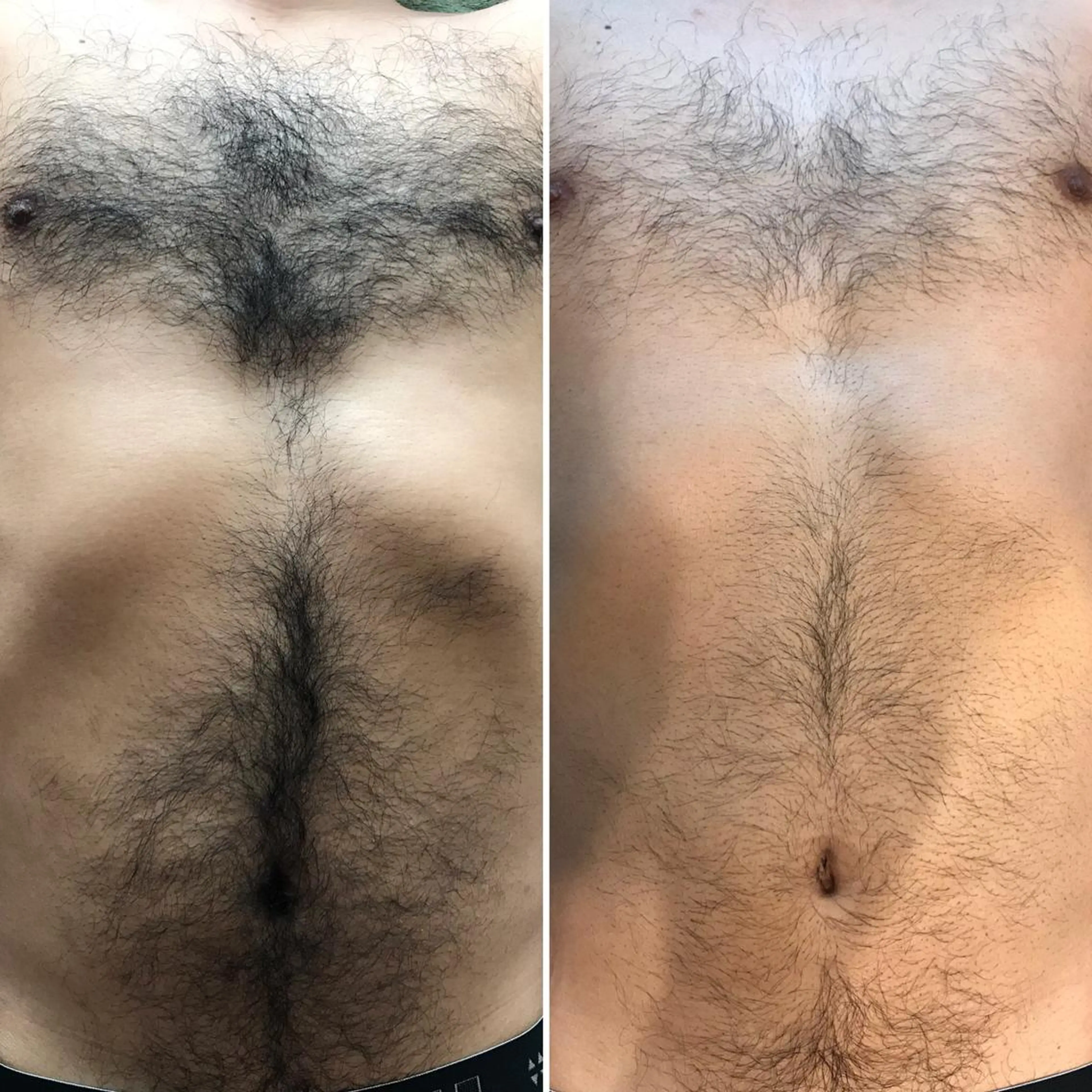 ビューティーサロン リノアのエステ・リラクイメージ