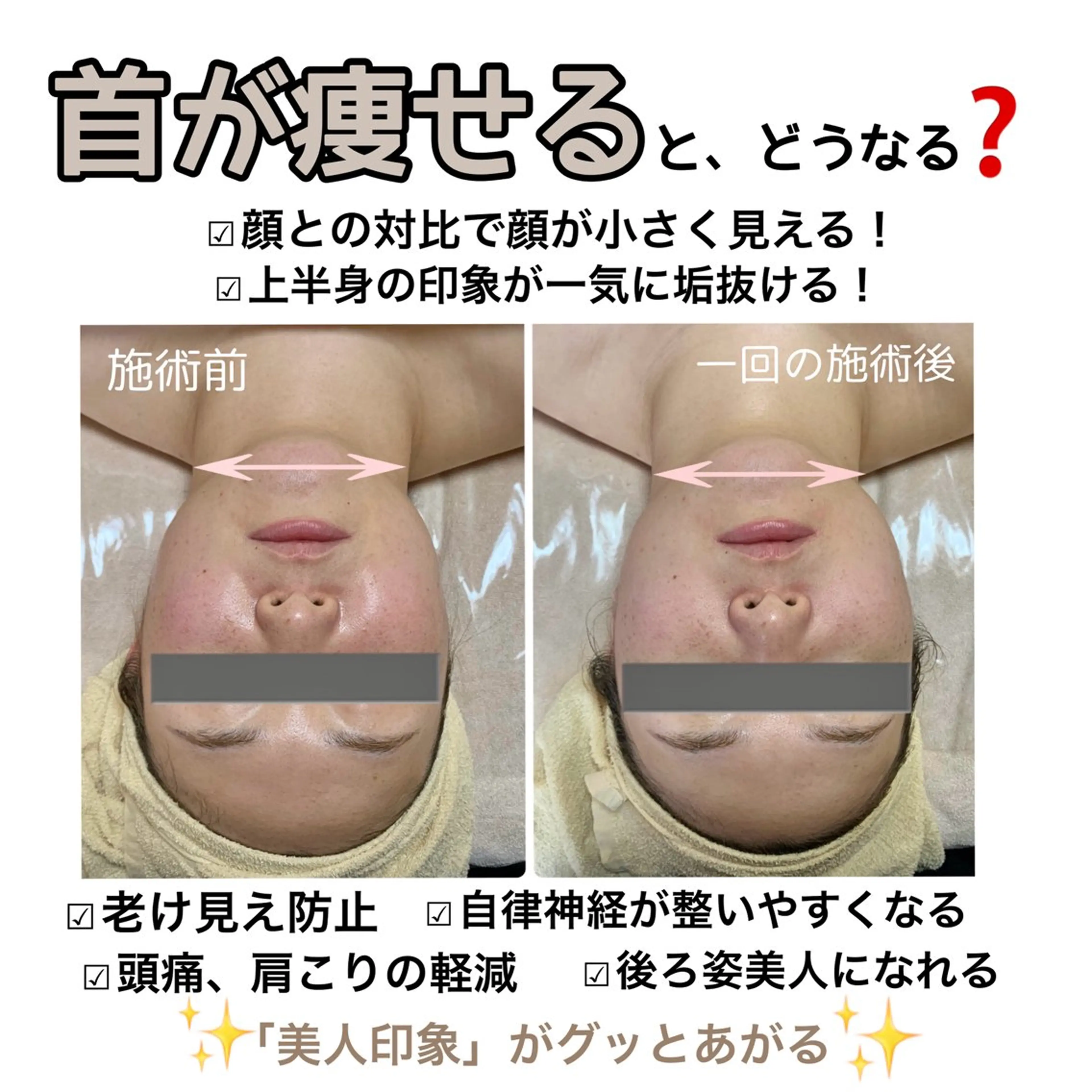 エステ stella所属・stella都度払い 痩身小顔まつげパーマのマツエク・マツパデザイン