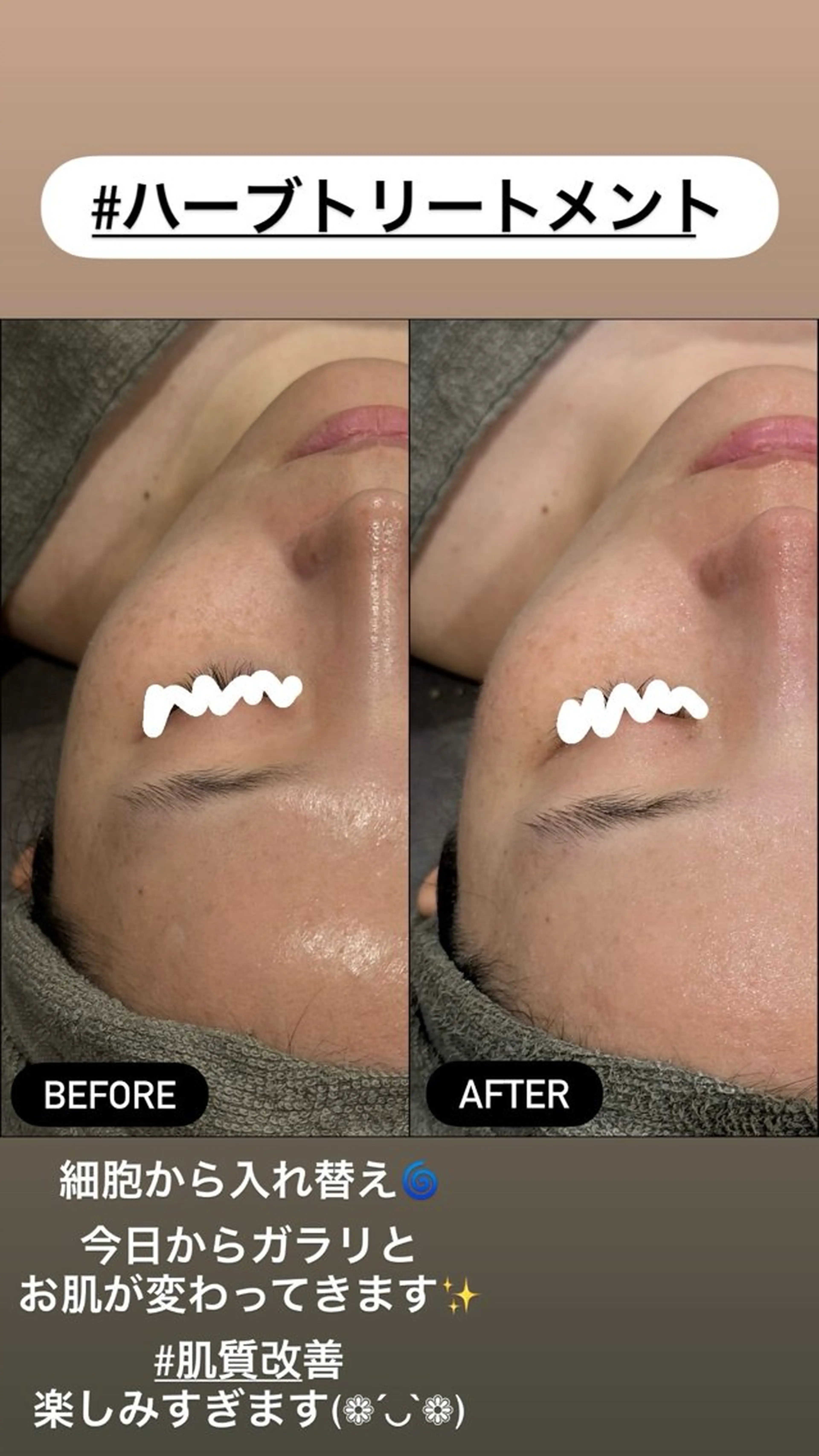 エステ LiZA エステティックサロンのエステ・リラクイメージ