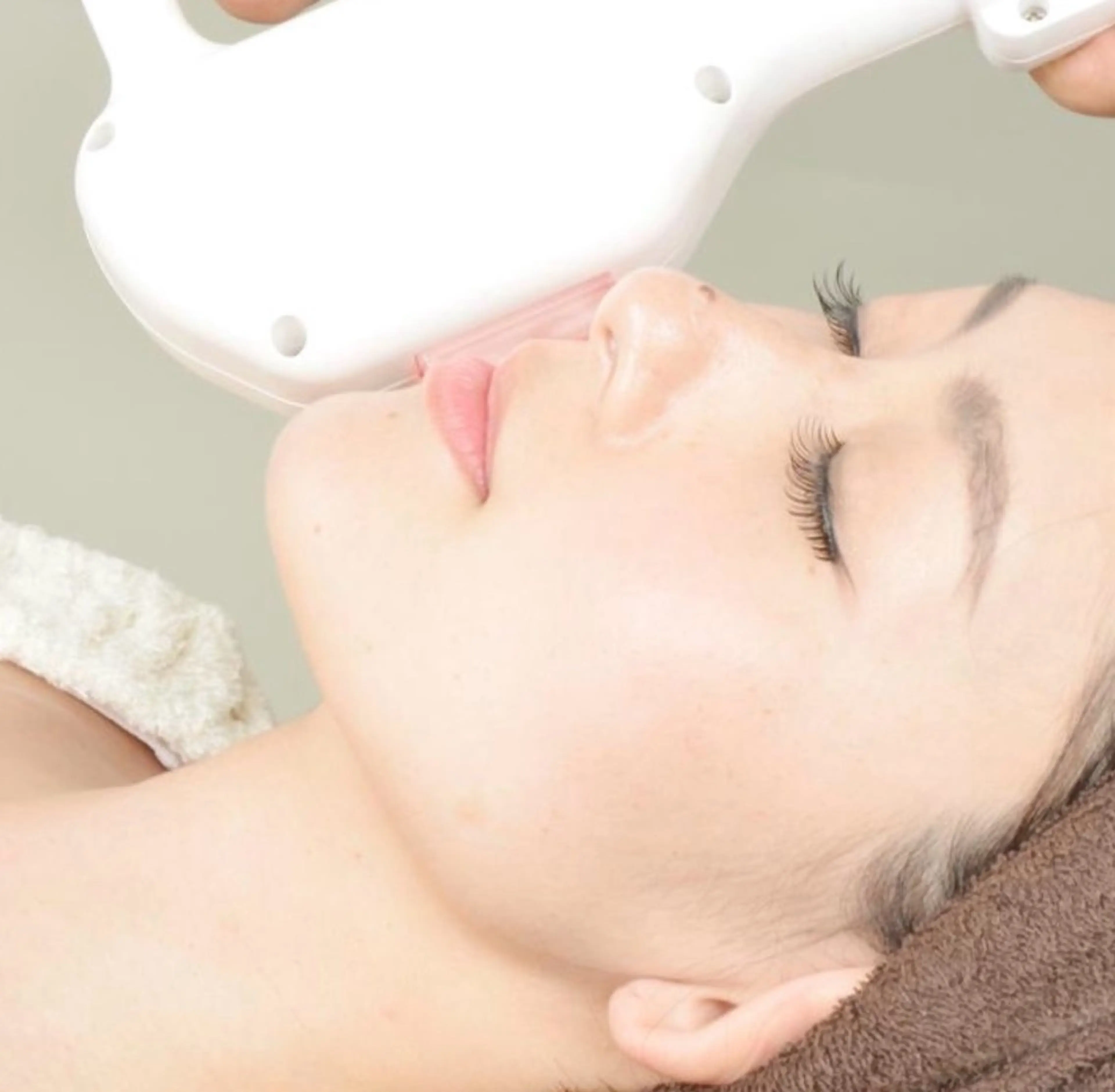 【女性】顔セット【額/ほほ/鼻下/あご/もみあげ】※施術相談ありの写真