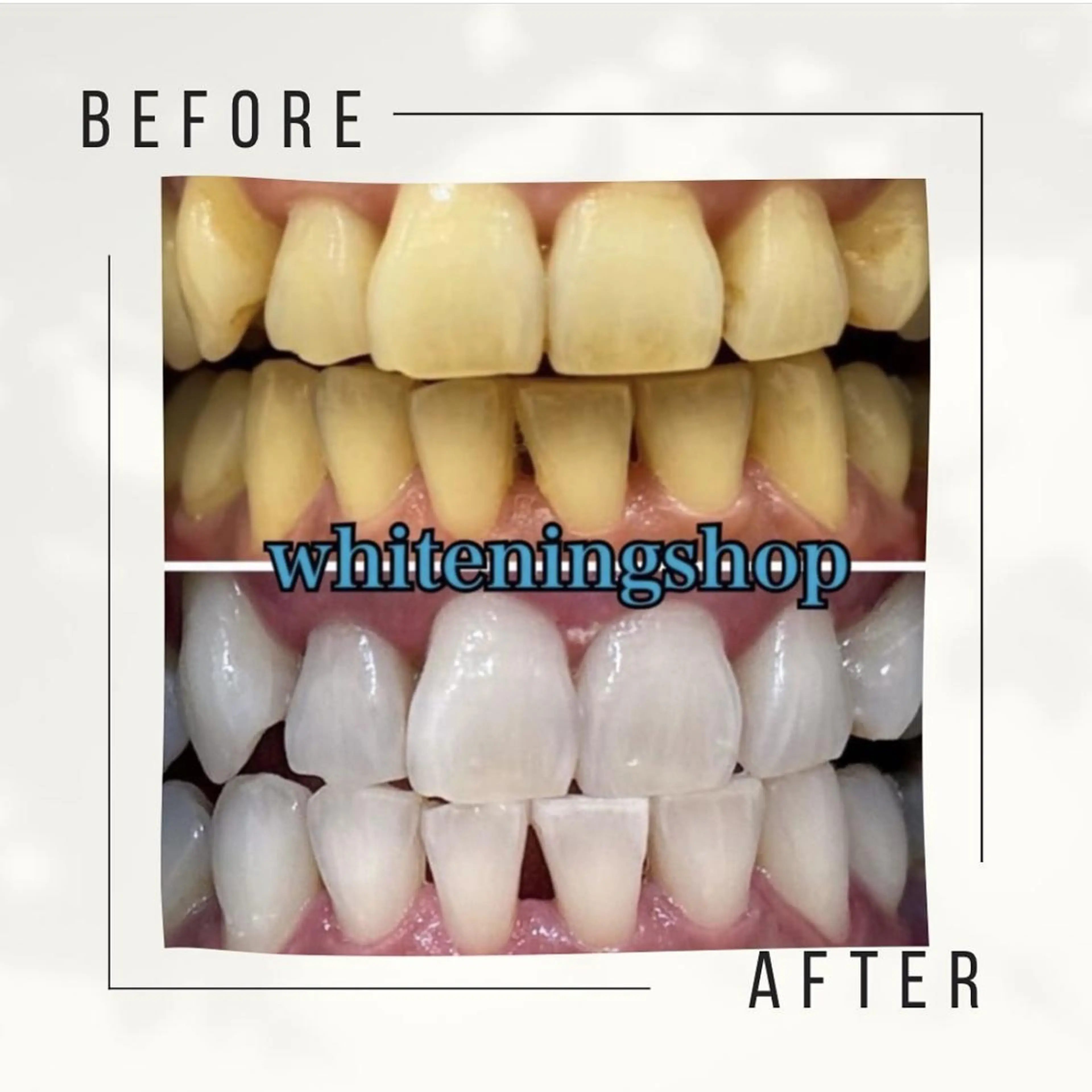 ホワイトニング ショップ千葉店のその他イメージ