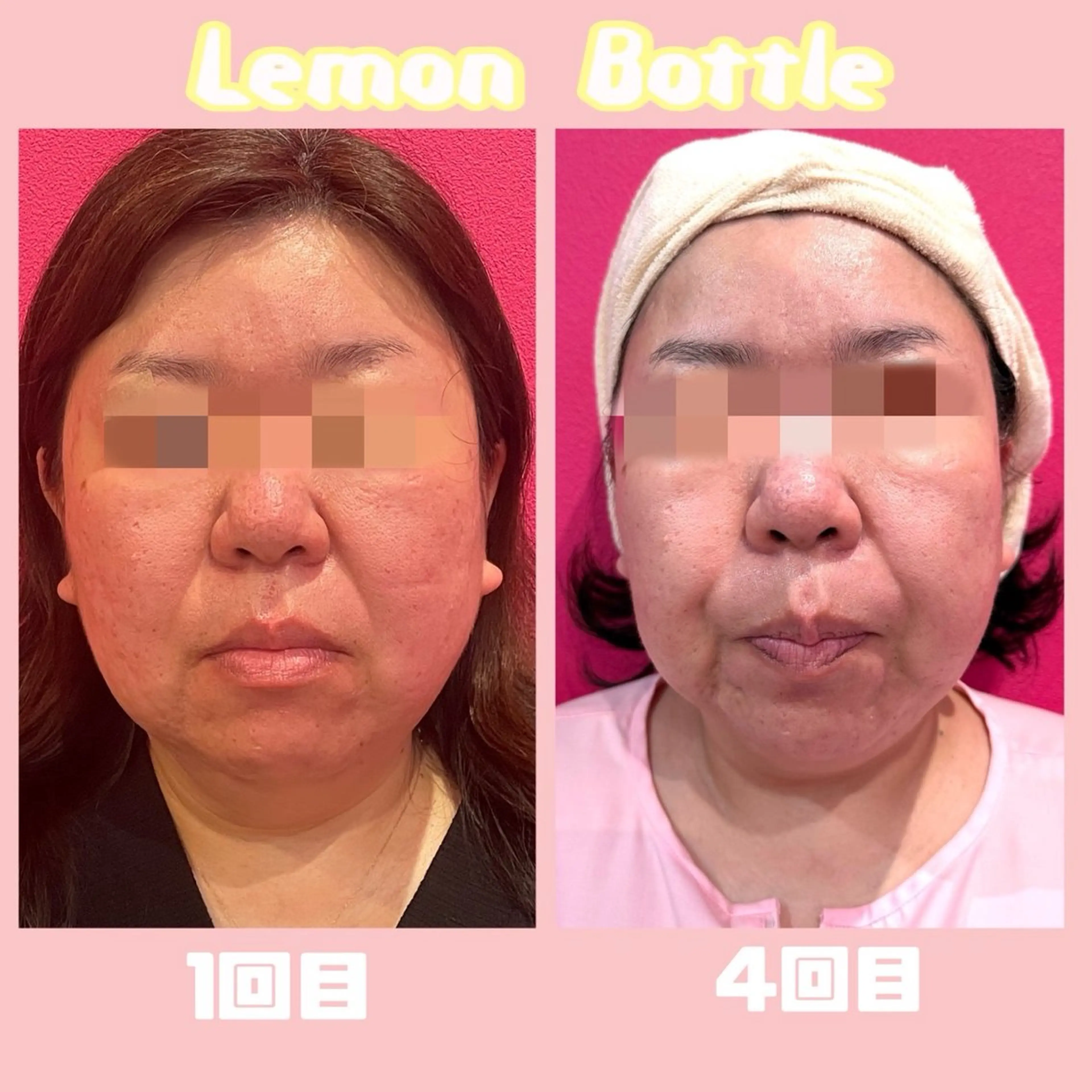 SOIS上中居店所属・佐々木 麻裕のエステ・リラクイメージ