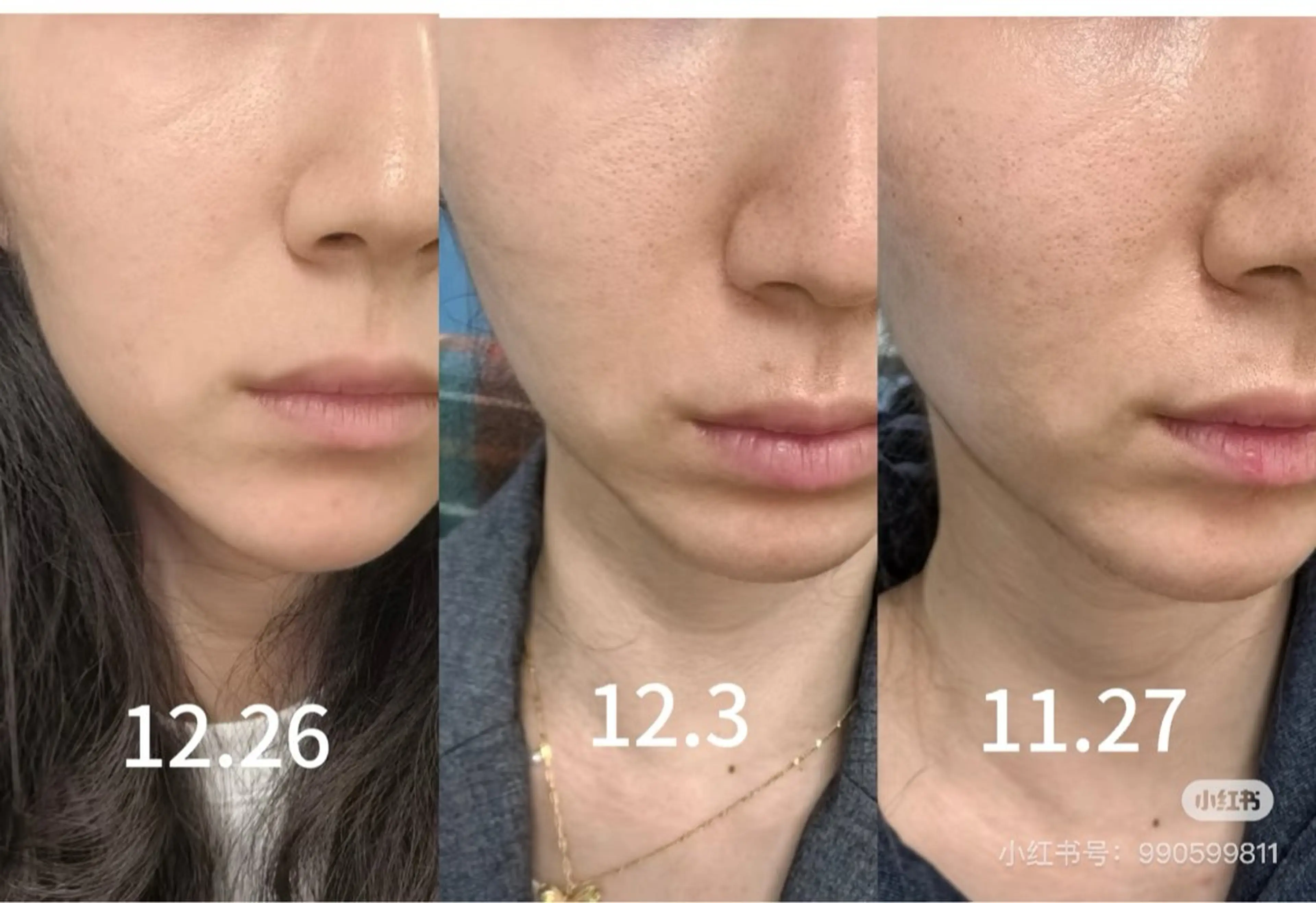 マツエク・マツパ エステ aliaハーブ水光店 エステティシャン募集のエステ・リラクイメージ