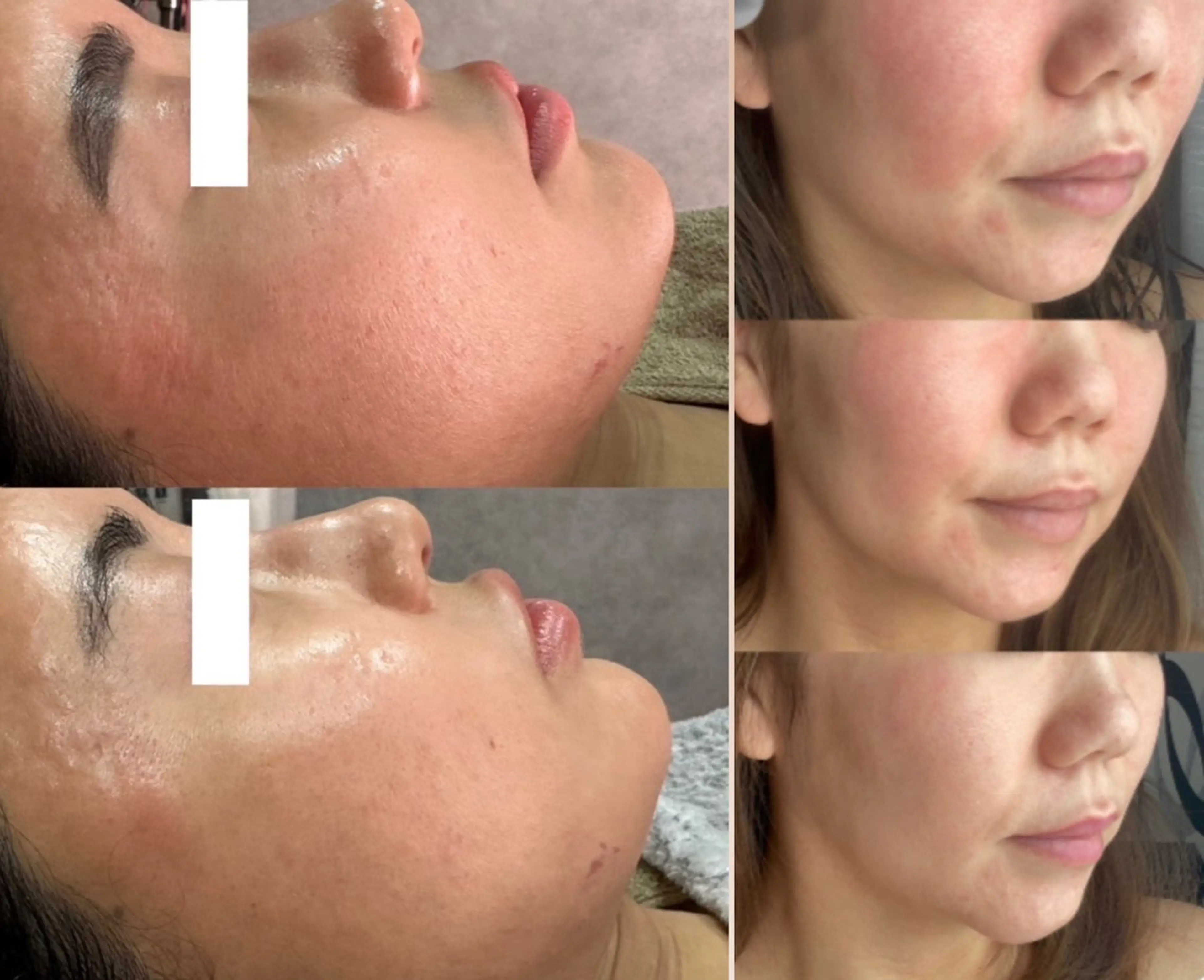 ALIA Scintiller  アリアサンティエ所属・齋藤 祐里耶のエステ・リラクイメージ