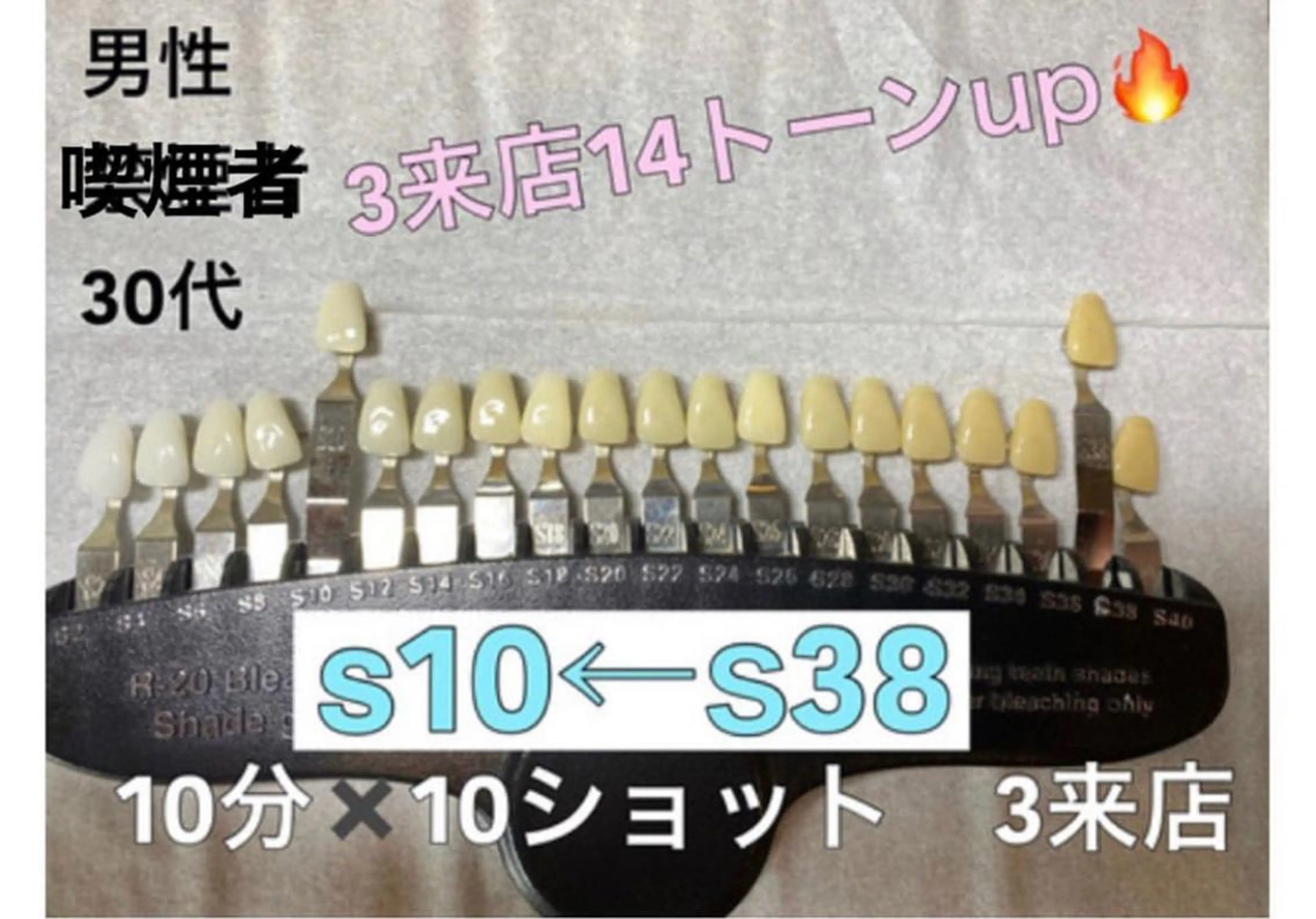 銀座de ホワイトニングのその他イメージ