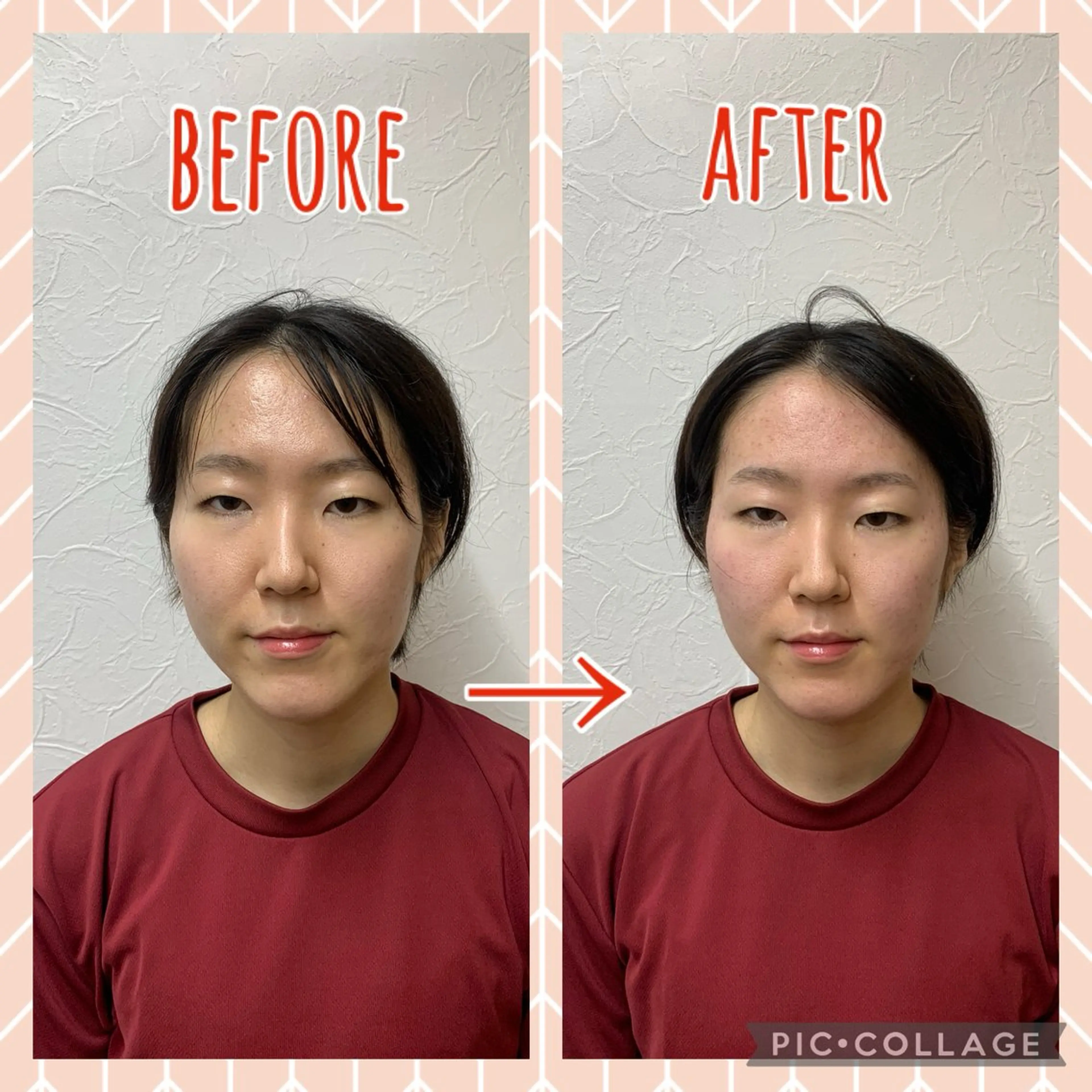 NO.10 整骨院のエステ・リラクイメージ