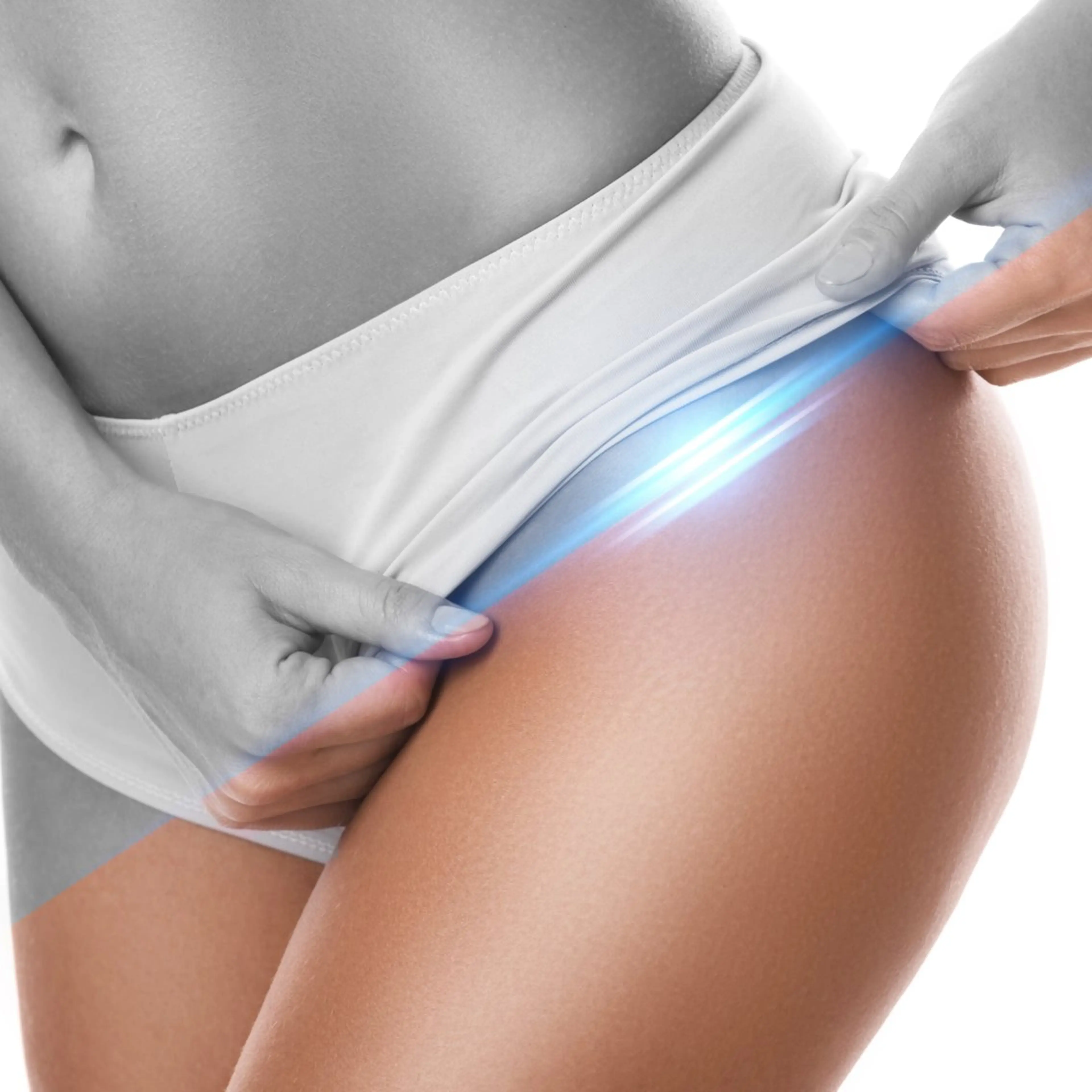 【ミニモ限定】ミニモ学割/光脱毛全身の写真