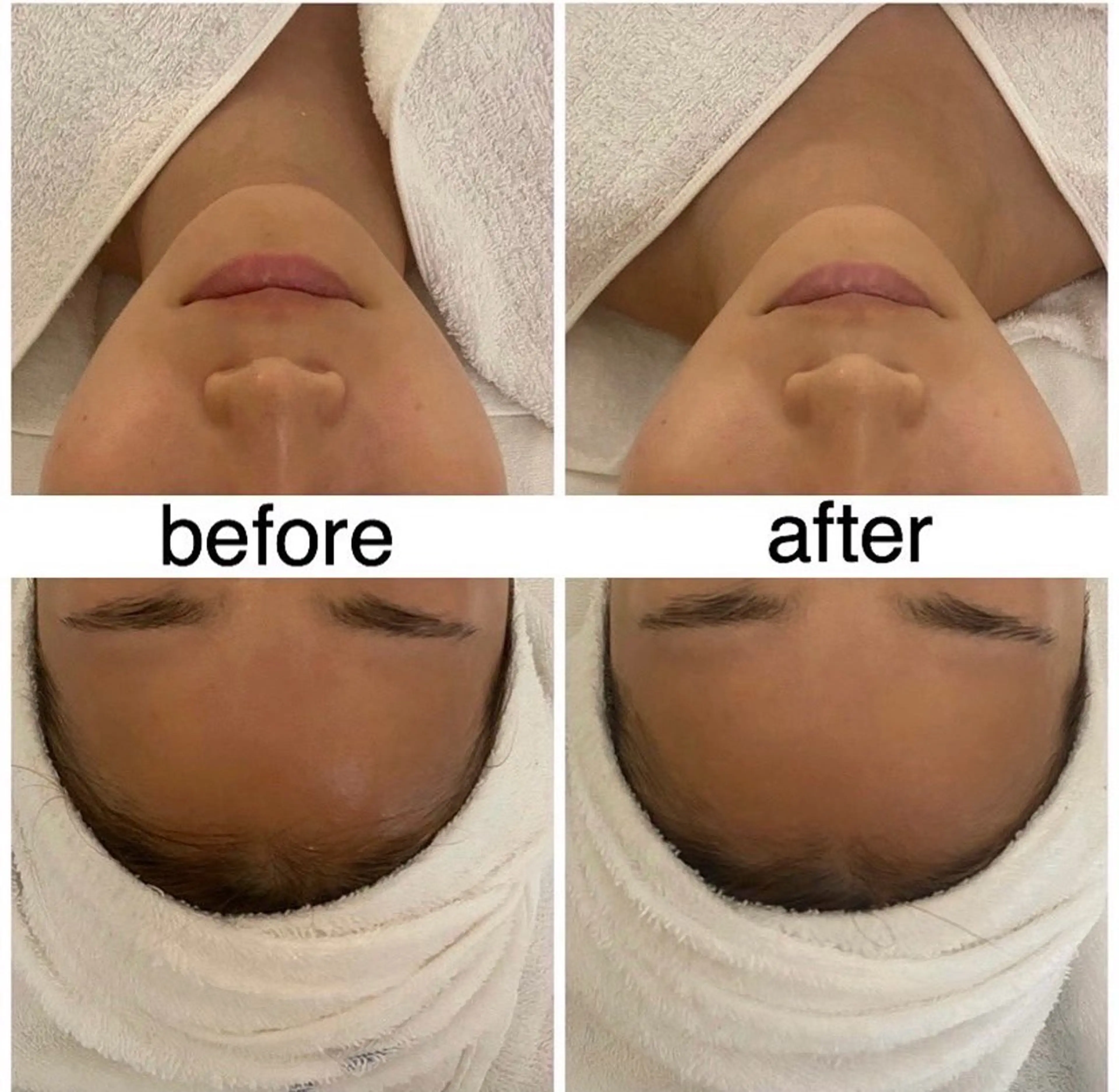 エステモデルの写真