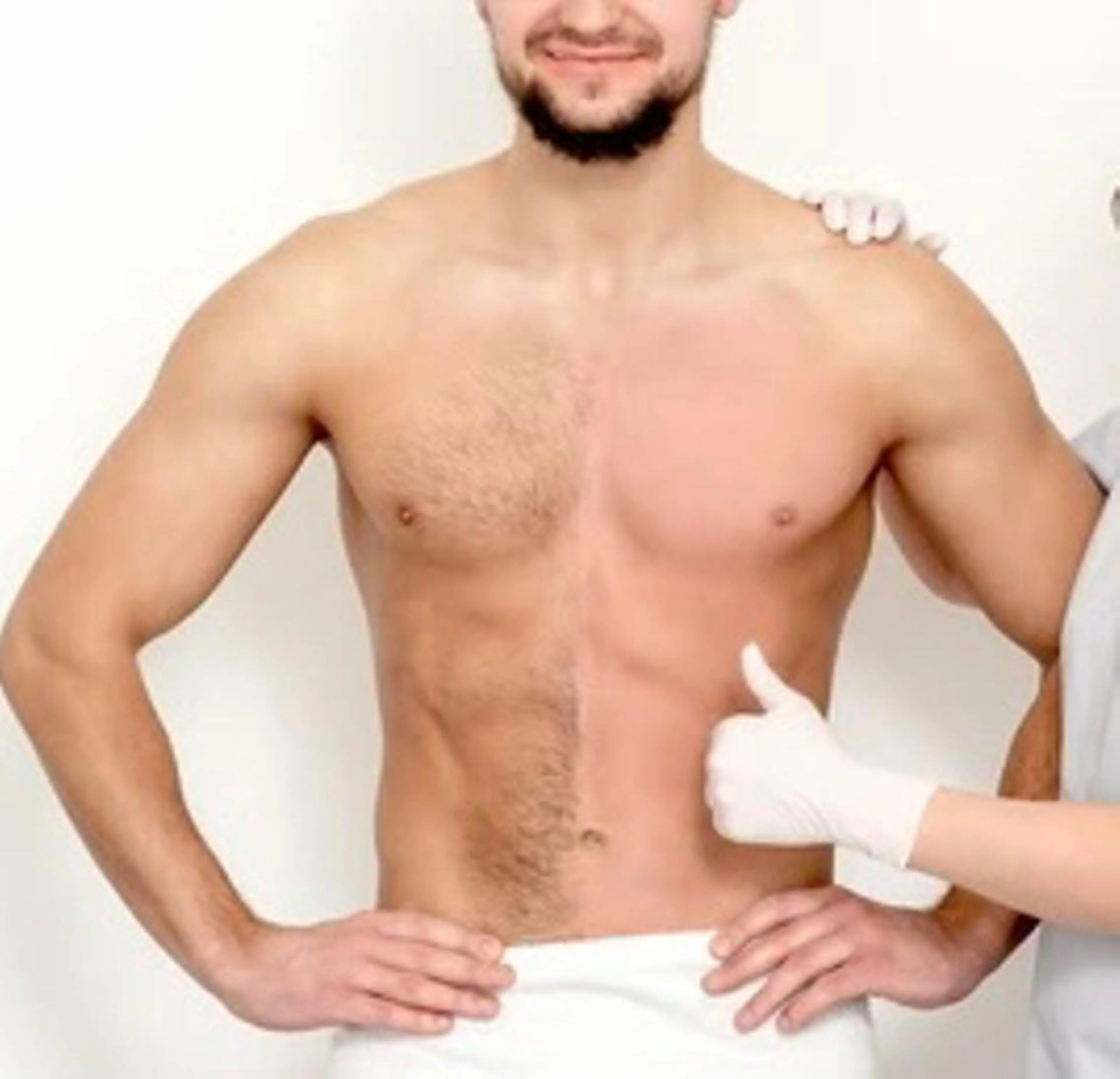 口コミ高評価🏅メンズ限定🔹最新脱毛機で全身脱毛(ヒゲ・VIO込み)の写真