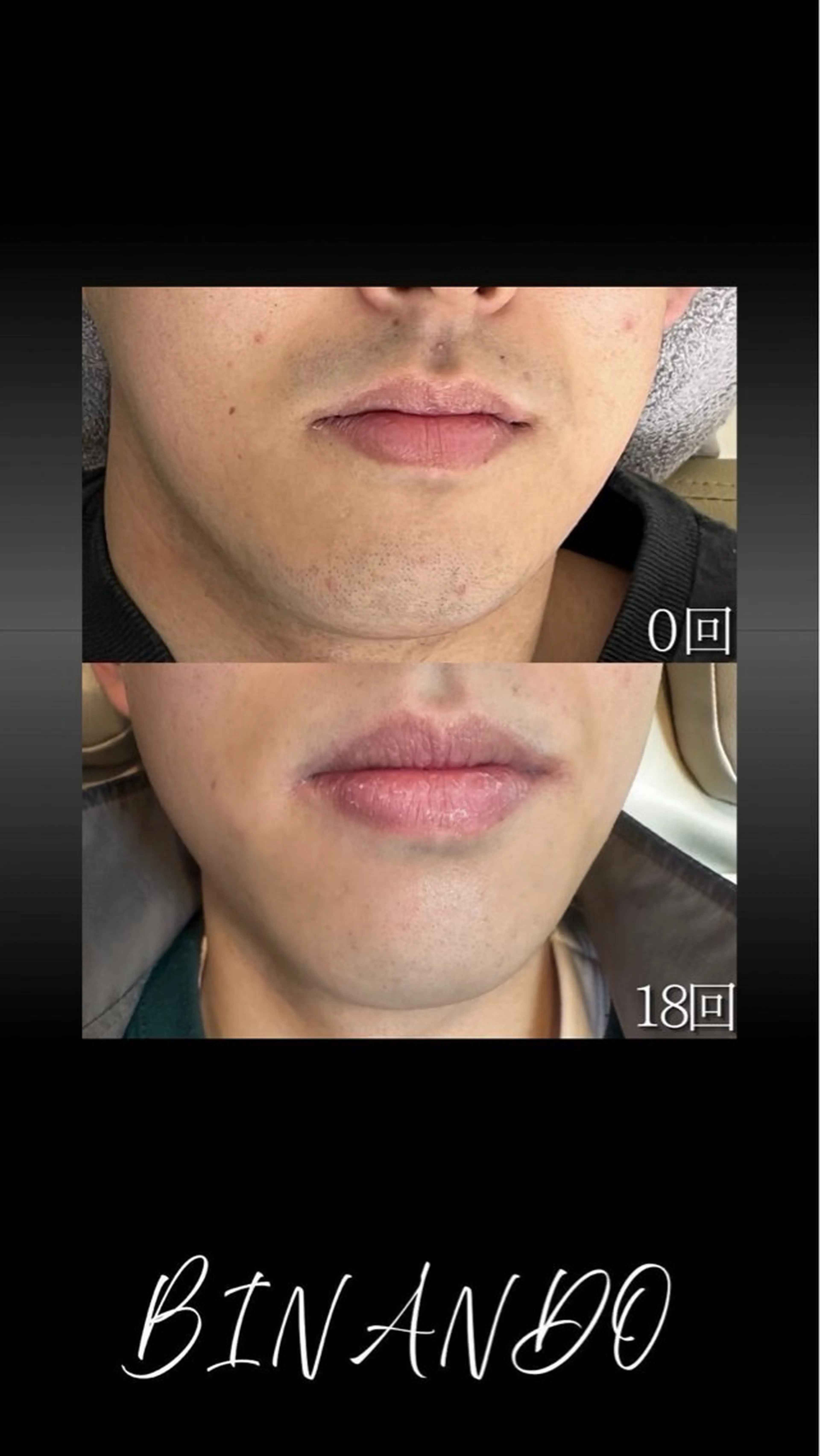 メンズ BINANDO 増田の眉毛・アイブロウイメージ