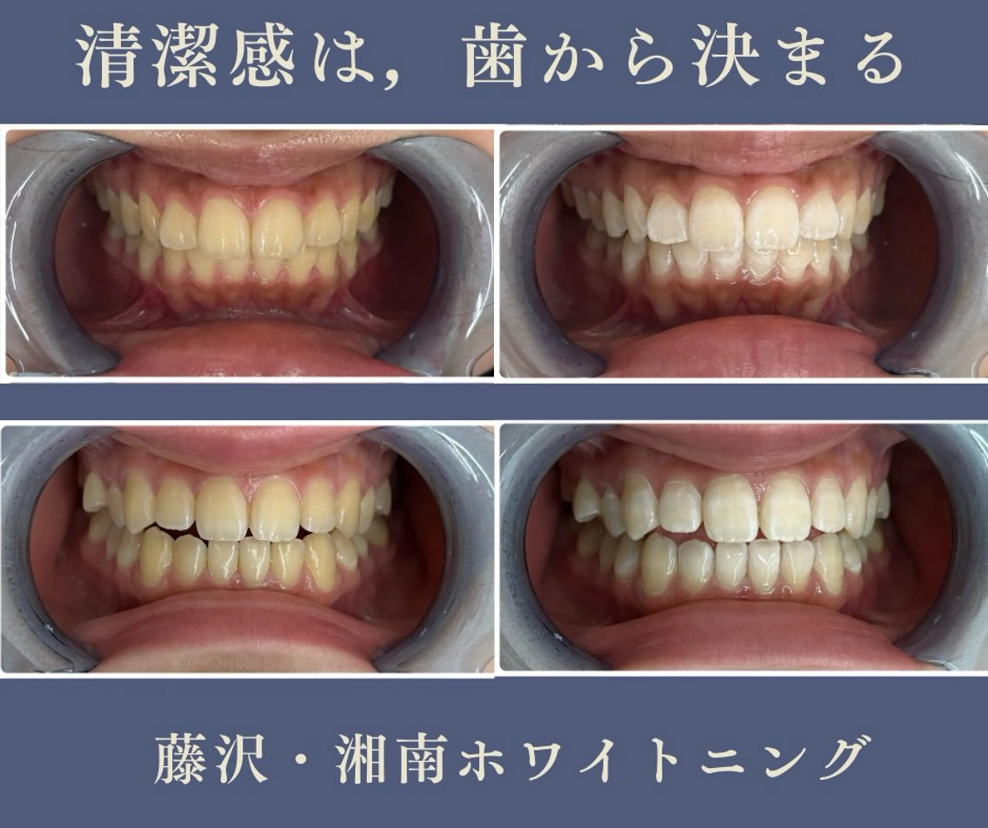 マツエク・マツパ エステ リラク ホワイトニング専門店 glitterのその他イメージ