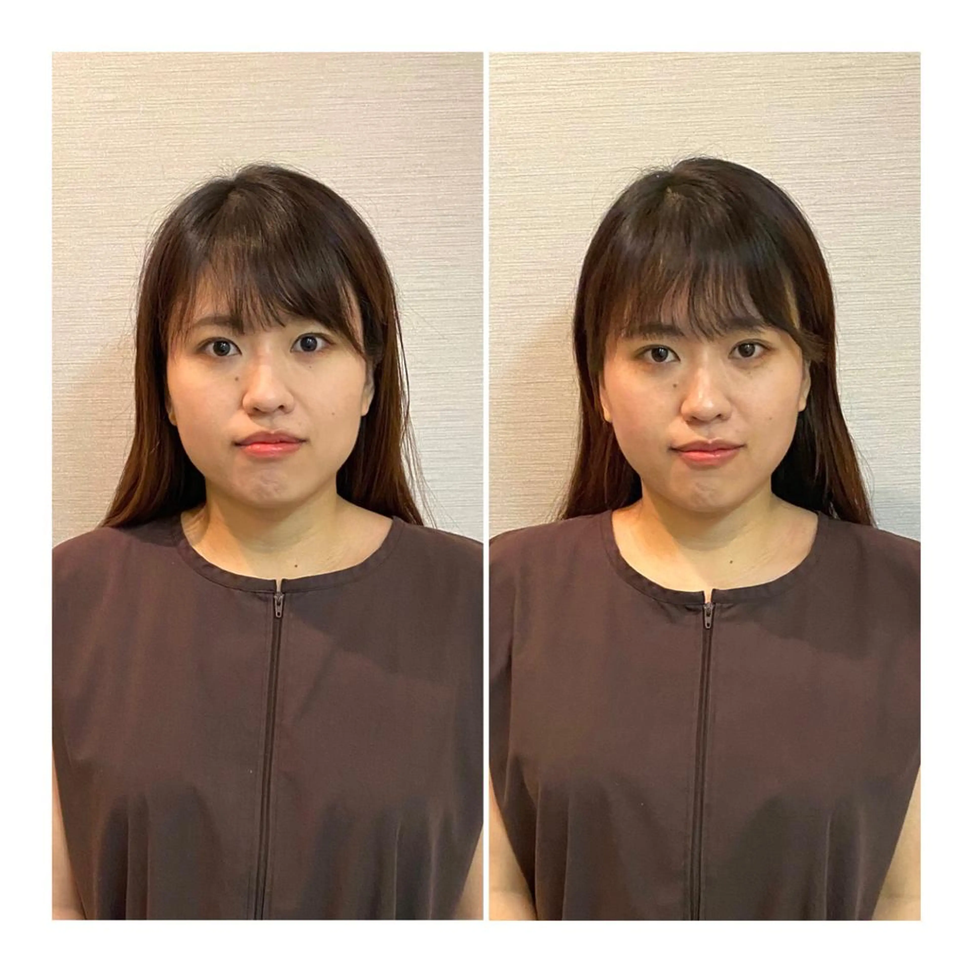 即小顔♥️美容鍼× ハーブピーリングのその他イメージ