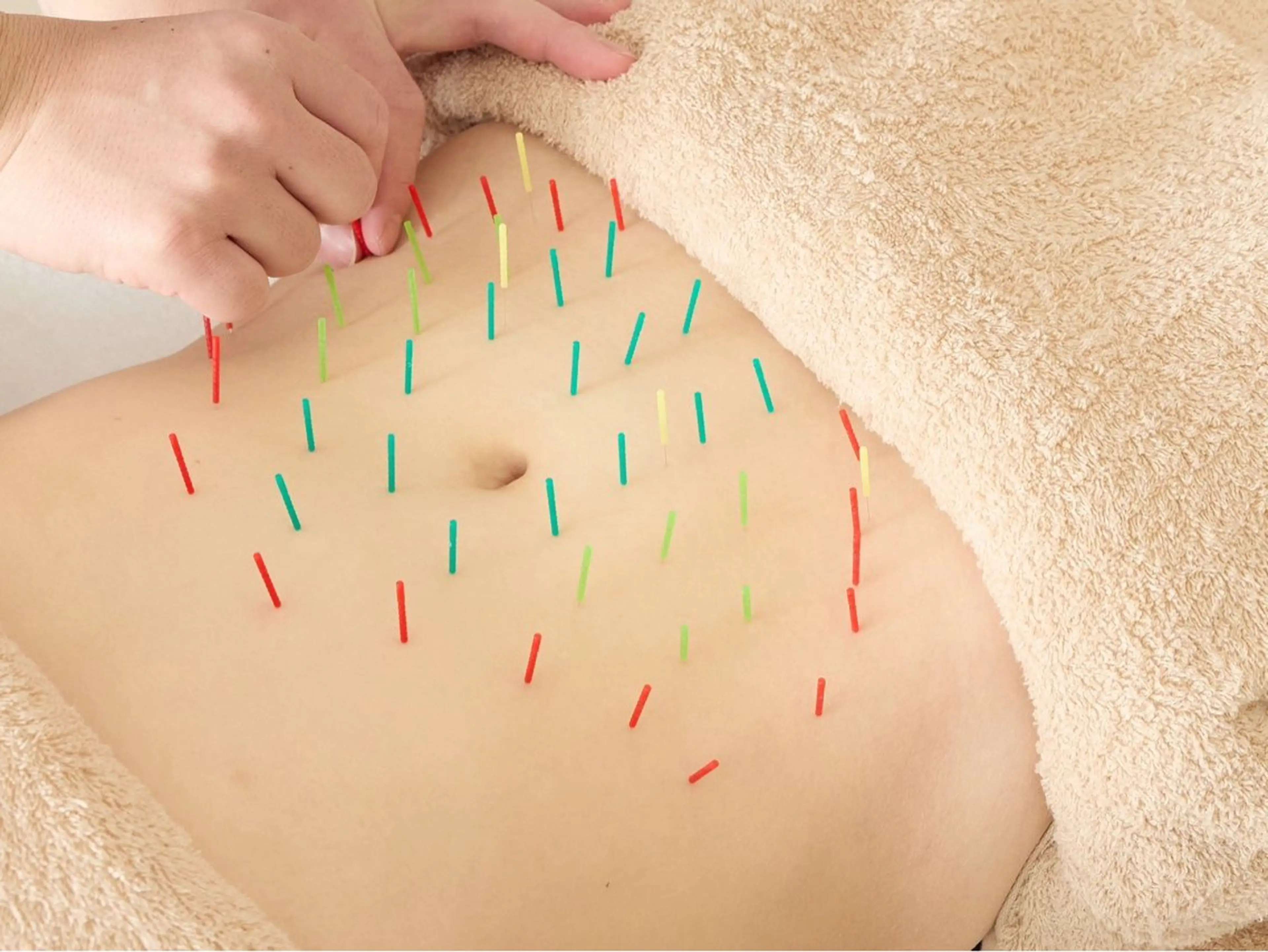 【minimo限定】東洋医学に基づいた不妊施術!!妊活の為の温活🪡の写真