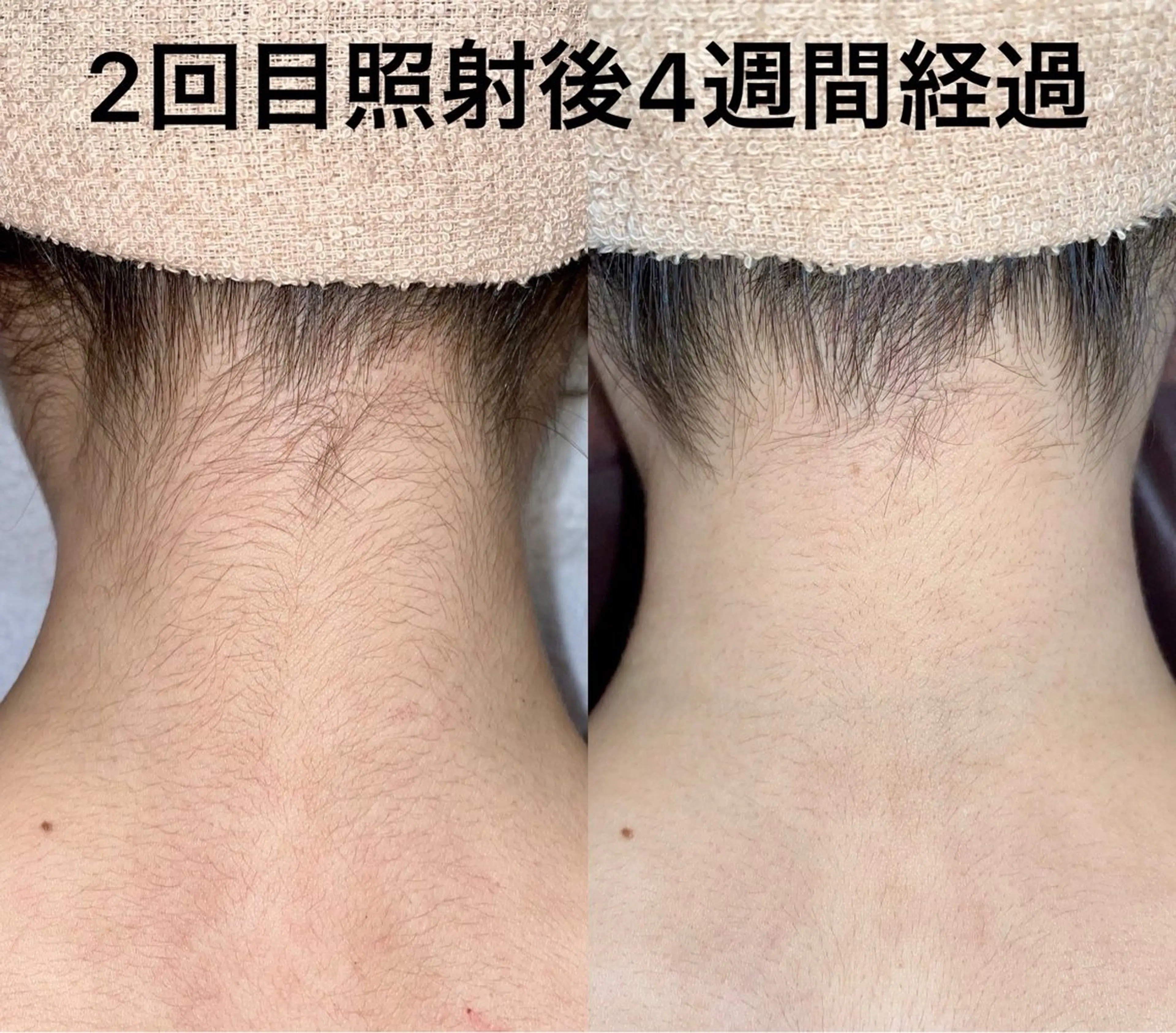 グレイスフルルーム所属・【本格脱毛】 グレイスフルルームのエステ・リラクイメージ