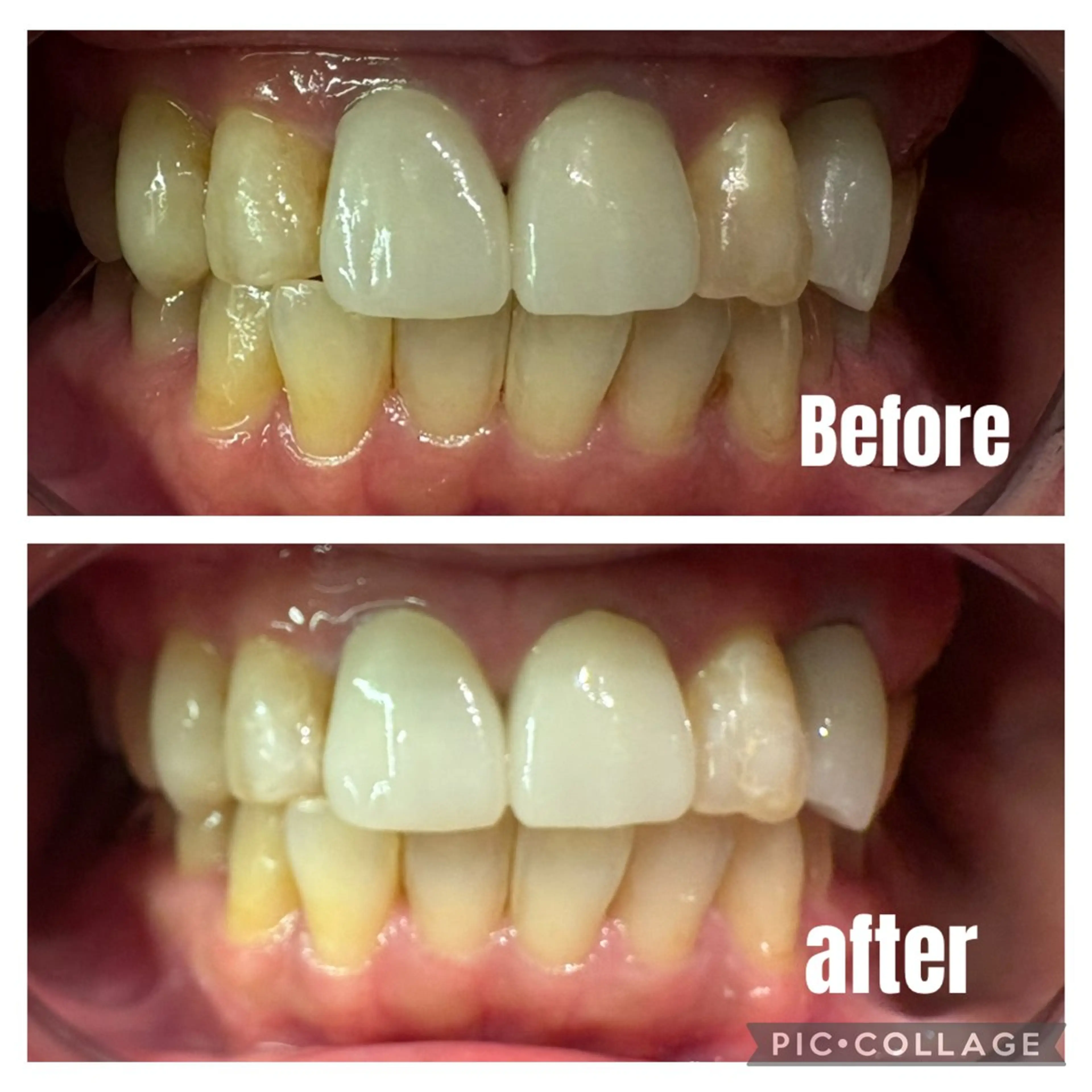 その他 Kalama whitening salon所属・カラマ ホワイトニングサロンのその他イメージ