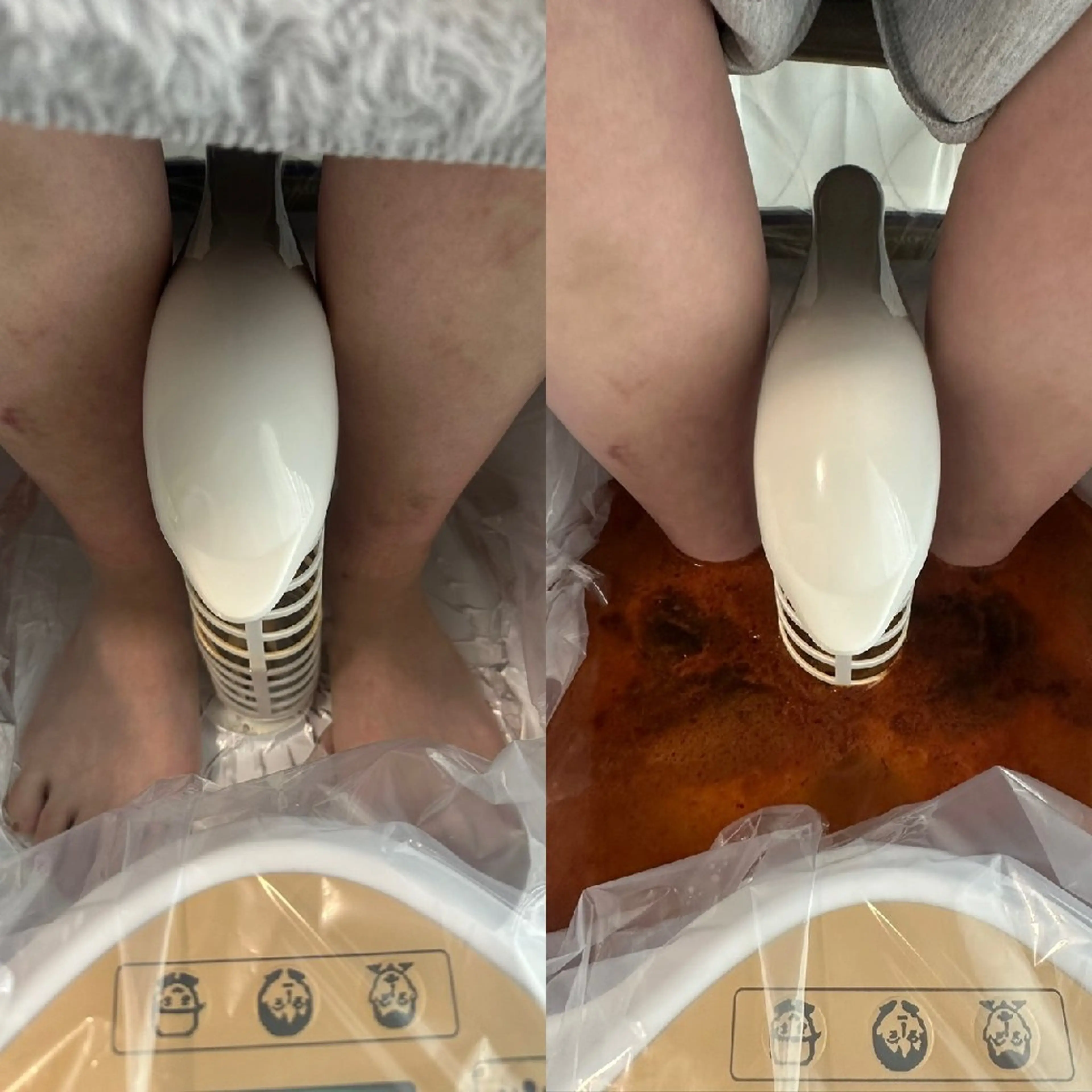 【人気No.1】高濃度水素足浴（ゴッドクリーナー）60分の写真