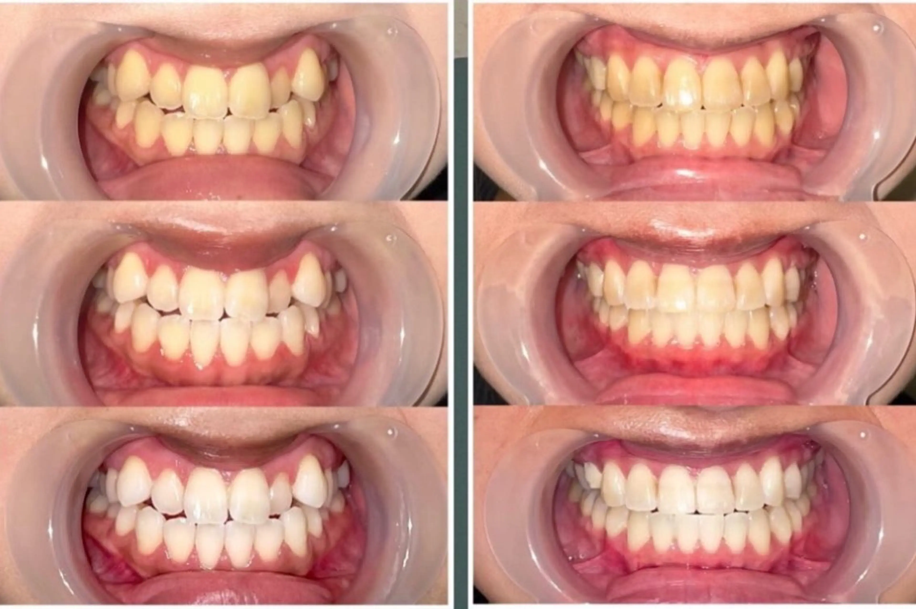 歯のセルフホワイトニング専門店GLOW(グロウ)所属・東区香椎歯のセルフホ ワイトニングGLOWのその他イメージ