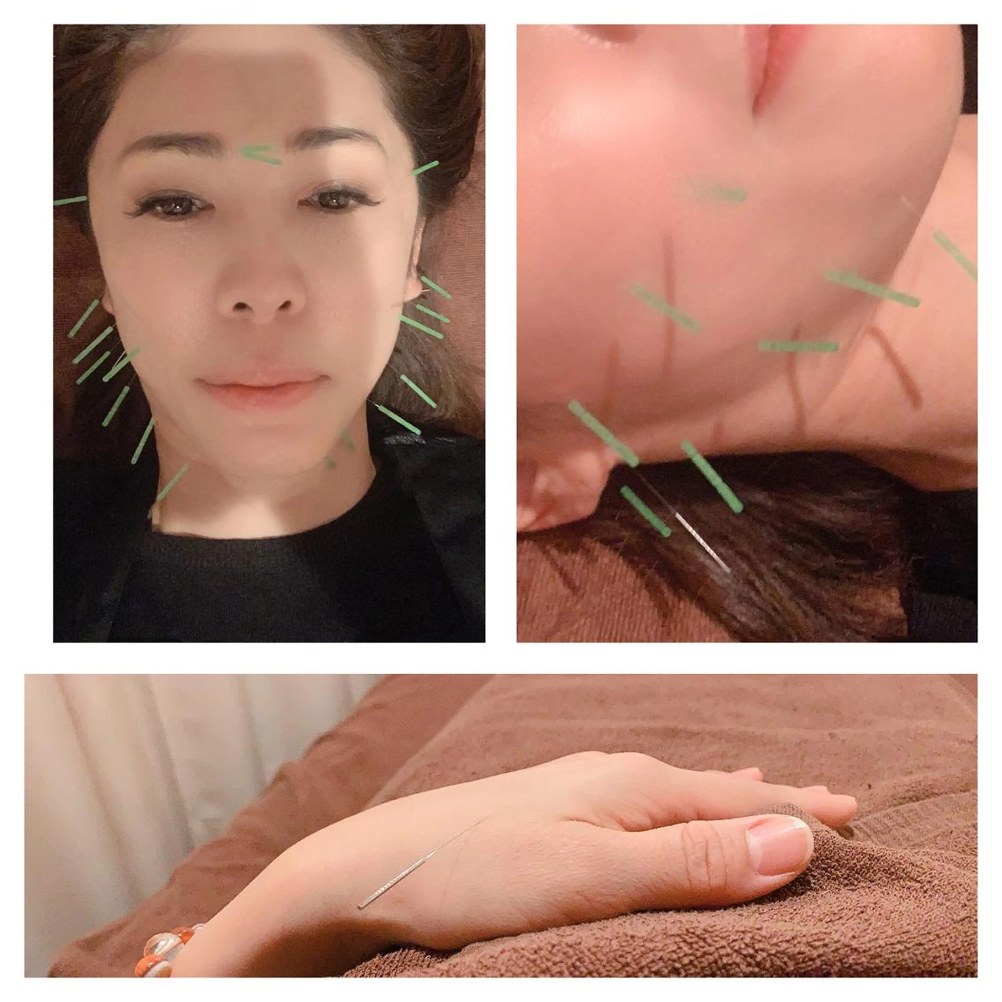 エステ リラク 美容鍼灸イロドリ のエステ・リラクイメージ