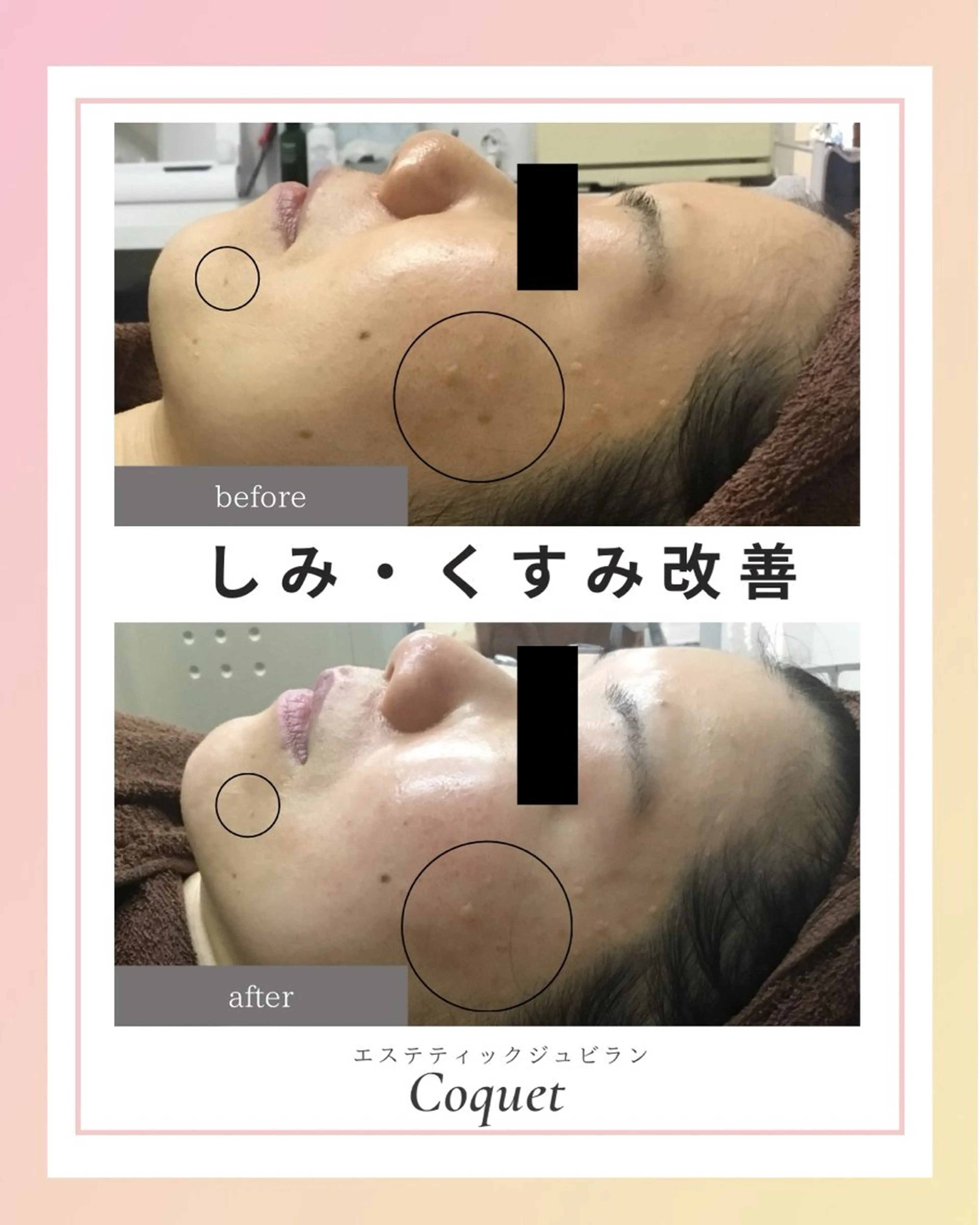 ジュビラン Coquetスタッフのエステ・リラクイメージ