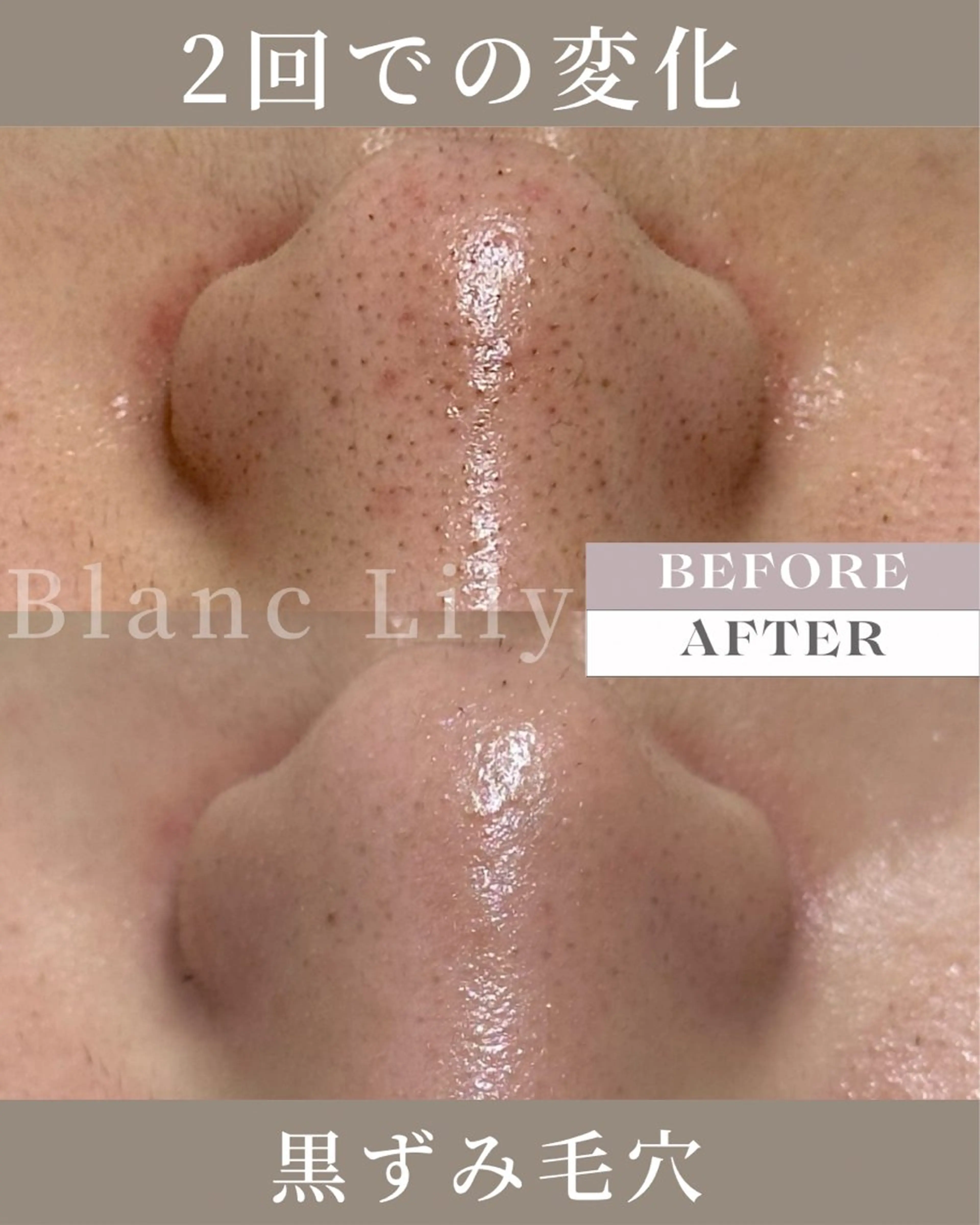 肌質改善サロンBlanc Lily【ブランリリー】所属・ピーリング専門サロン サロンブランリリーのエステ・リラクイメージ