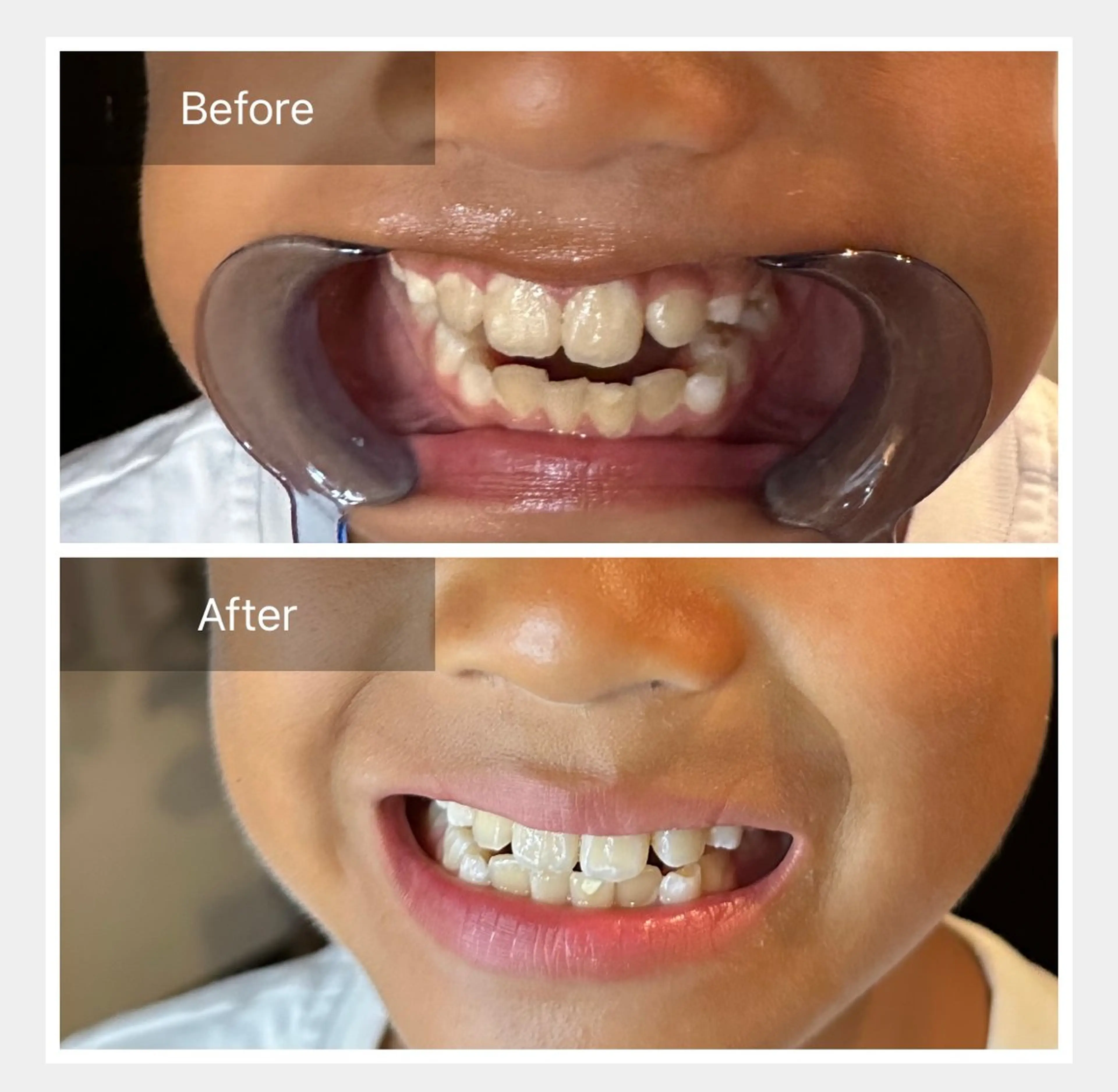 キッズ その他 リセットサロン RIKUU所属・谷四整体サロン RIKUU(りくう)のエステ・リラクイメージ