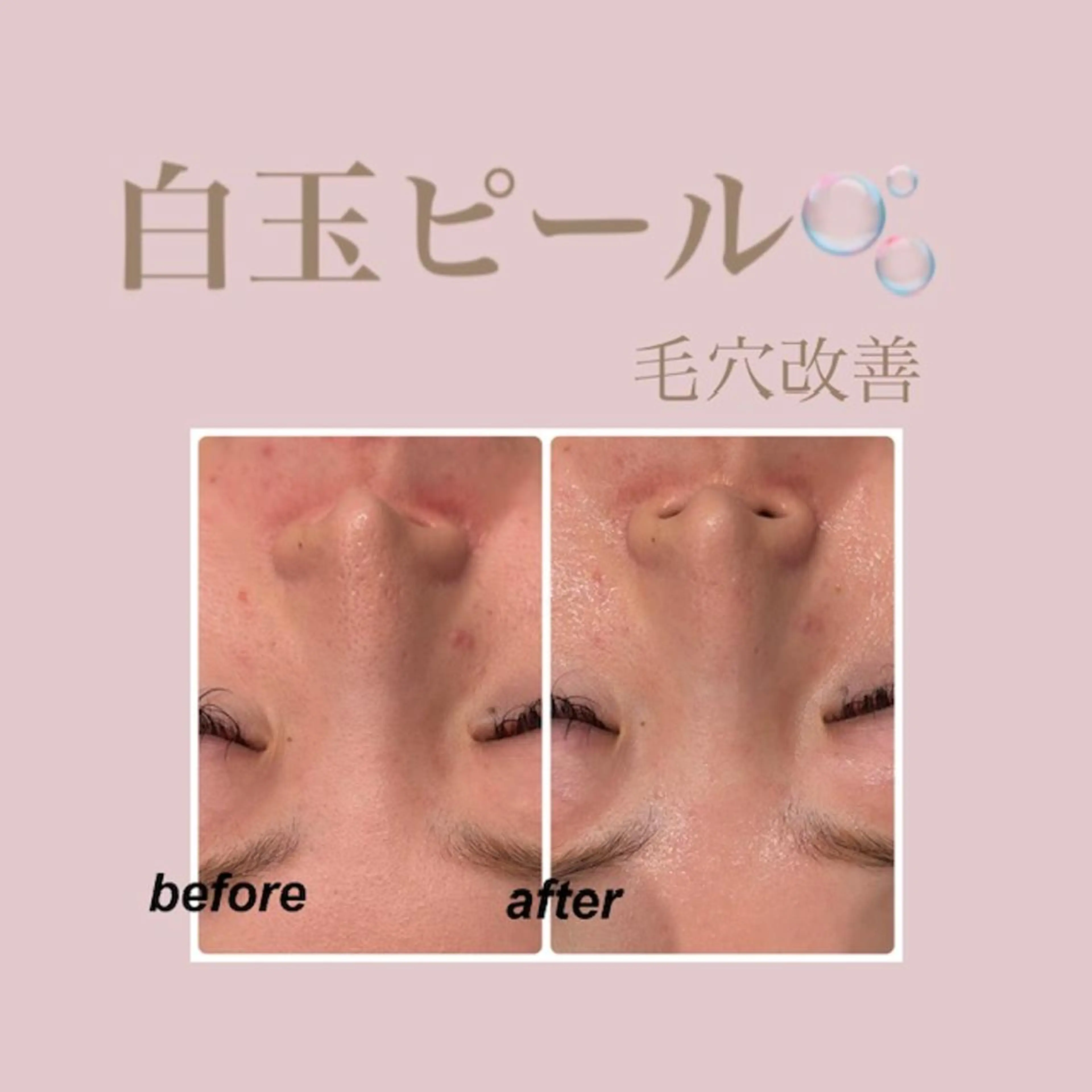 🤍Linola🤍 レイビス　須藤のエステ・リラクイメージ