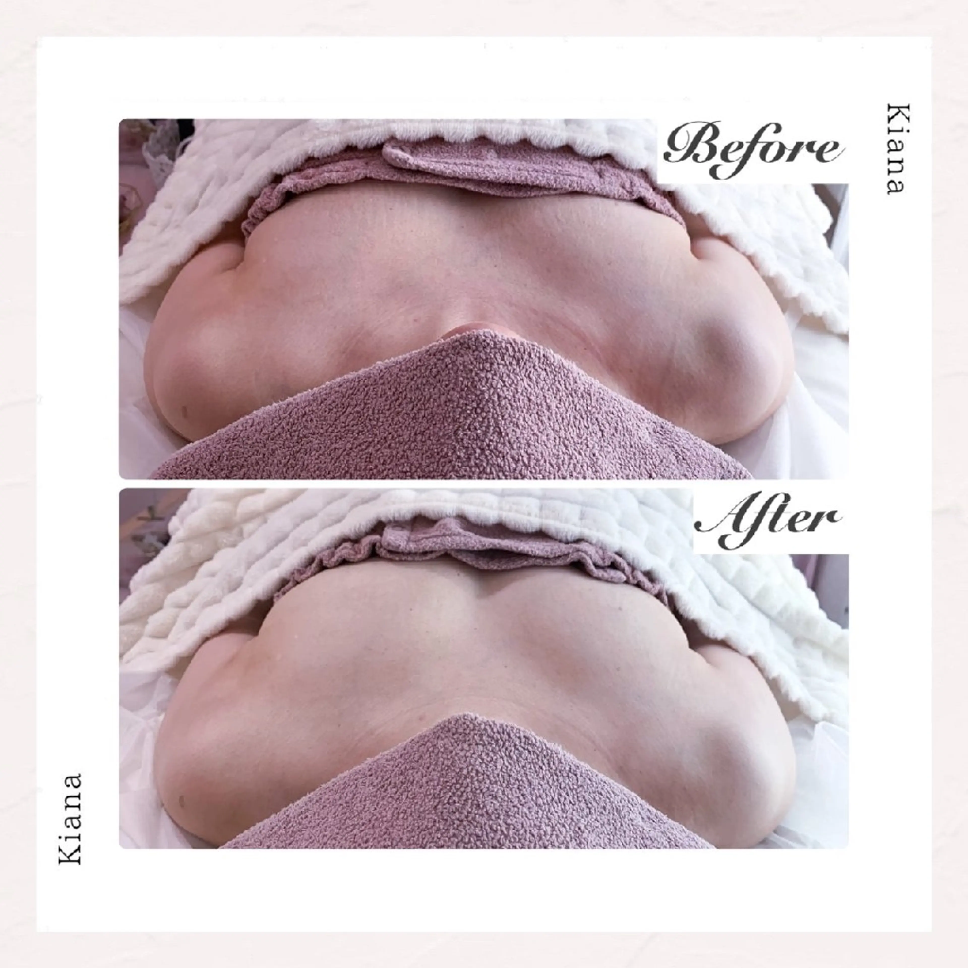 【バスト専門店 】 Kiana のエステ・リラクイメージ