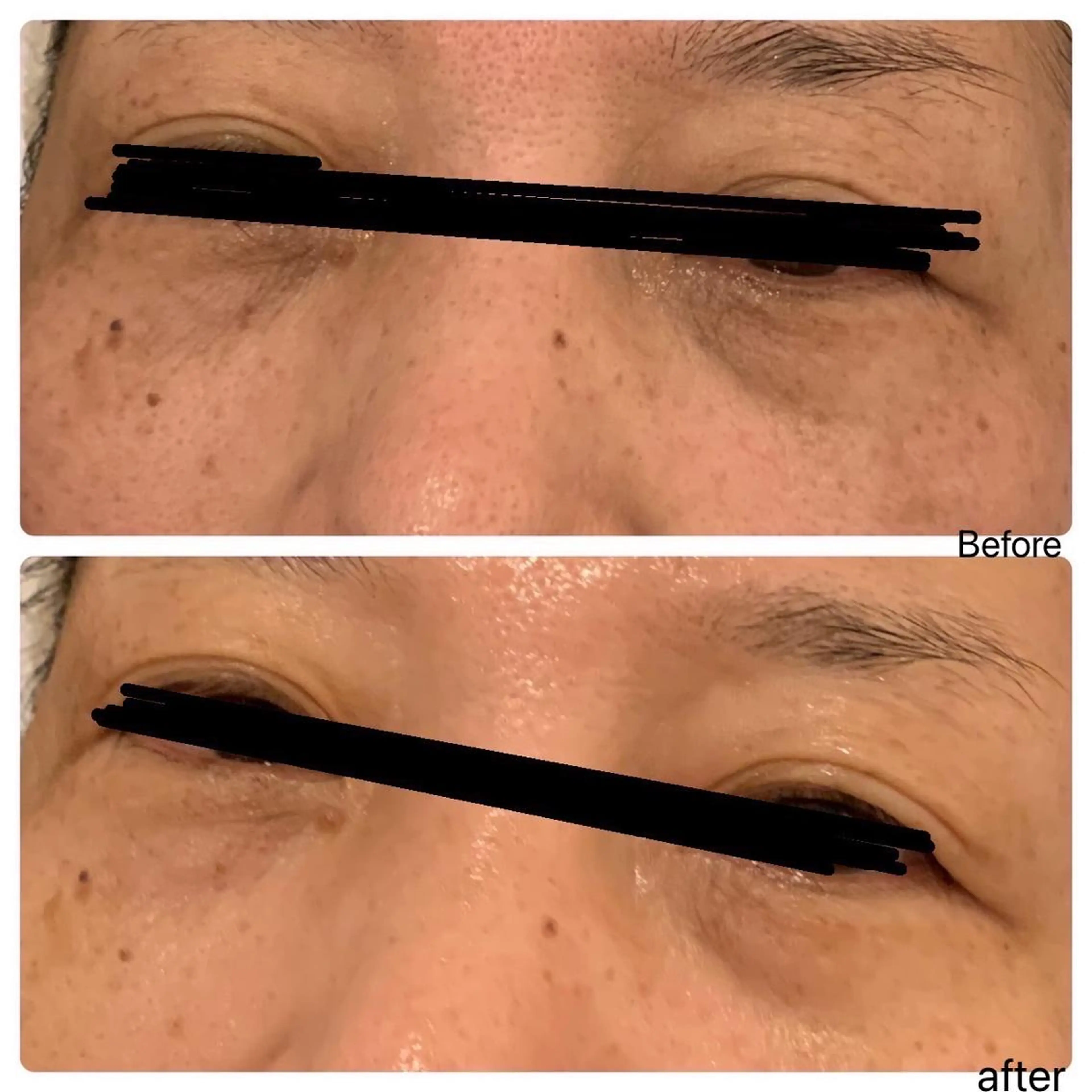 💆‍♀️オールハンドでフェイシャルマッサージの写真