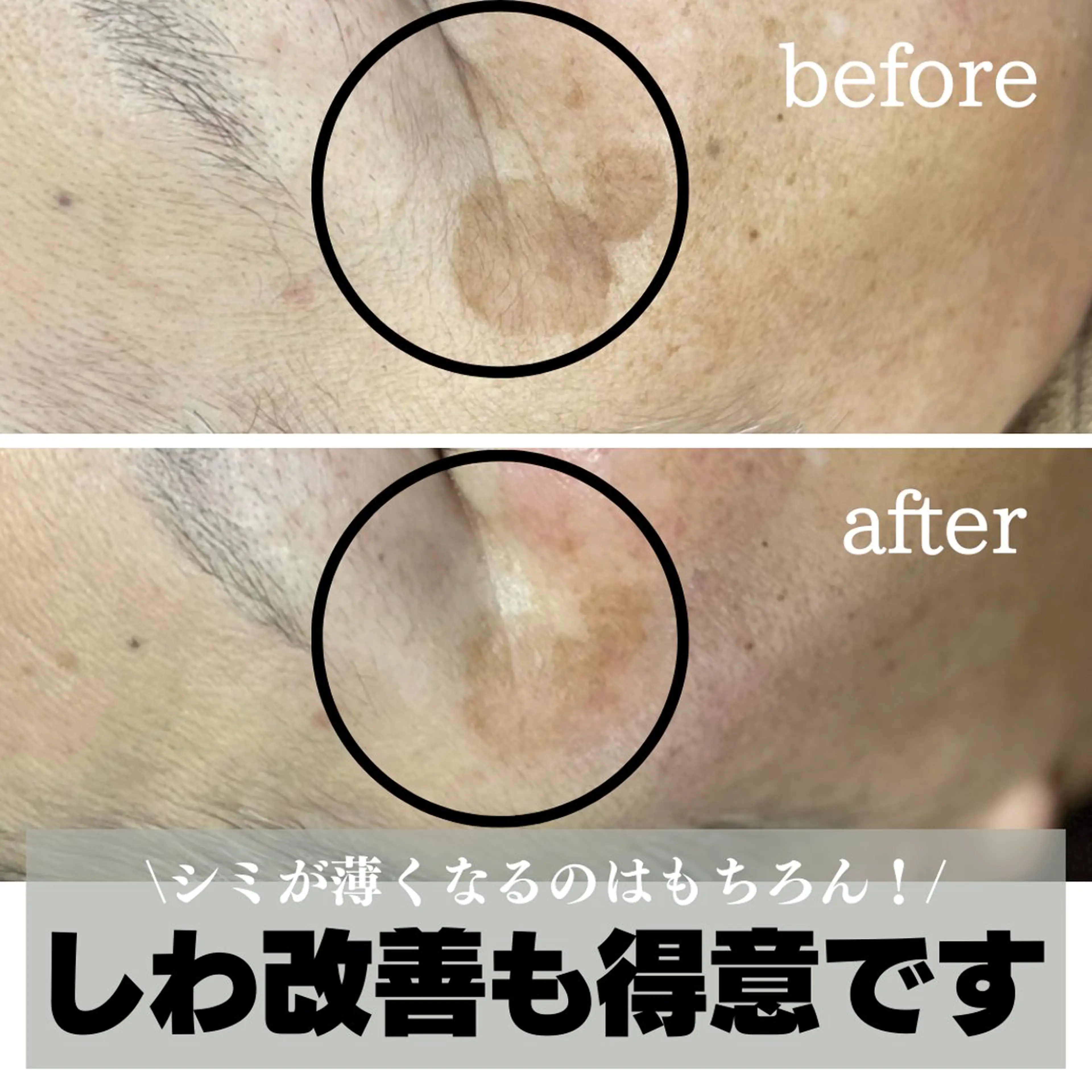 エステ 最新シミケアLily de pearlのエステ・リラクイメージ