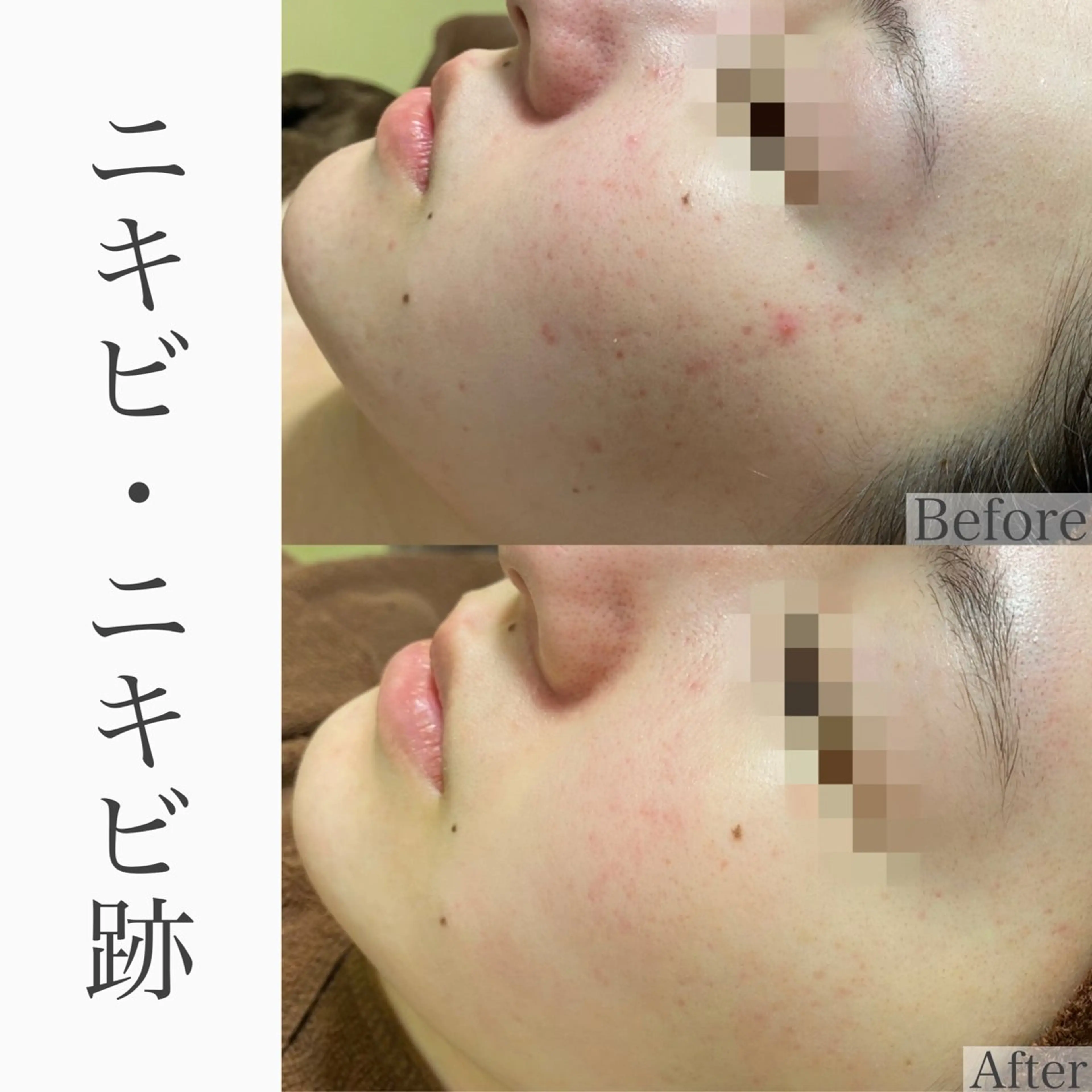 ハーブピーリング専門 BIOEL横浜のエステ・リラクイメージ