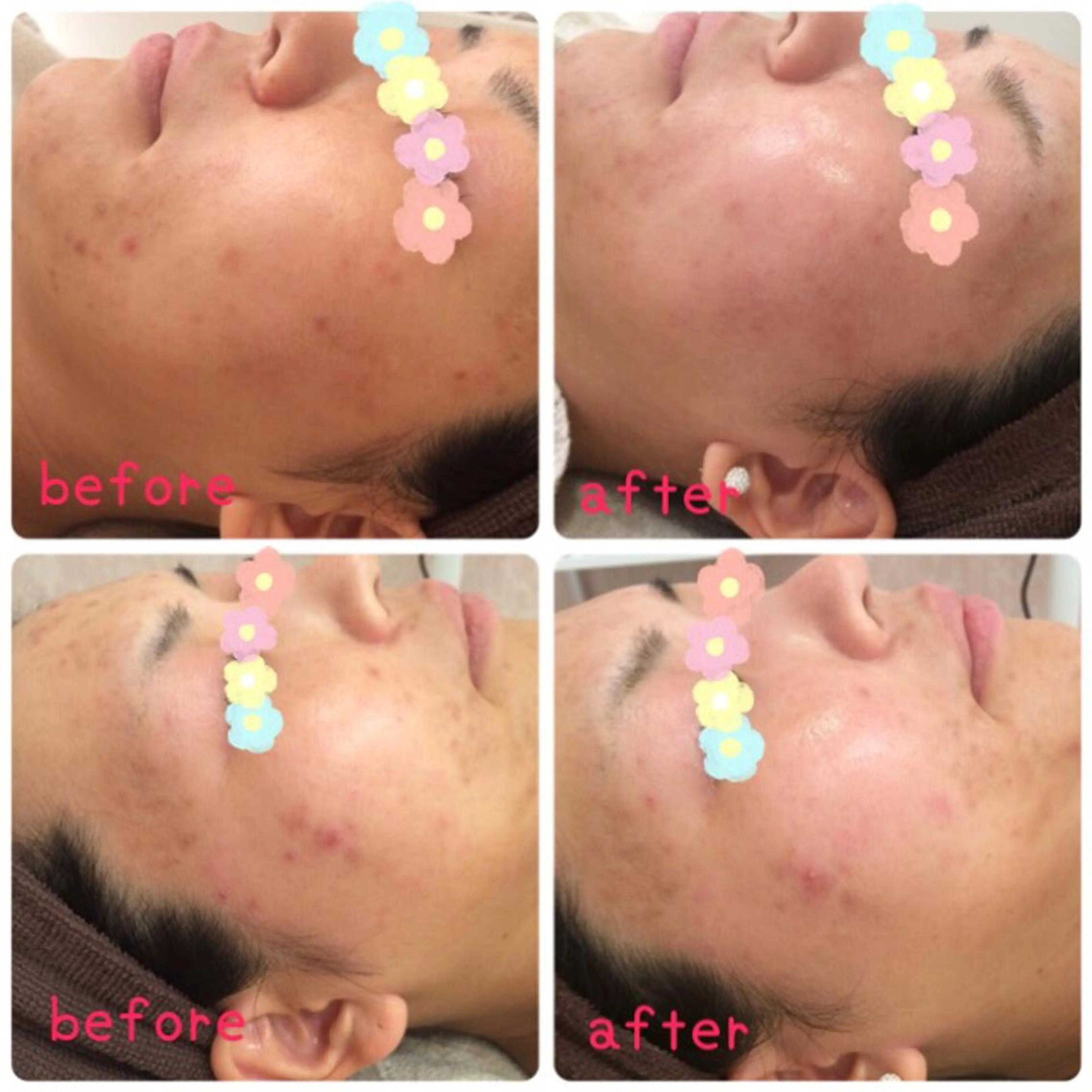 Larin la beauteのエステ・リラクイメージ