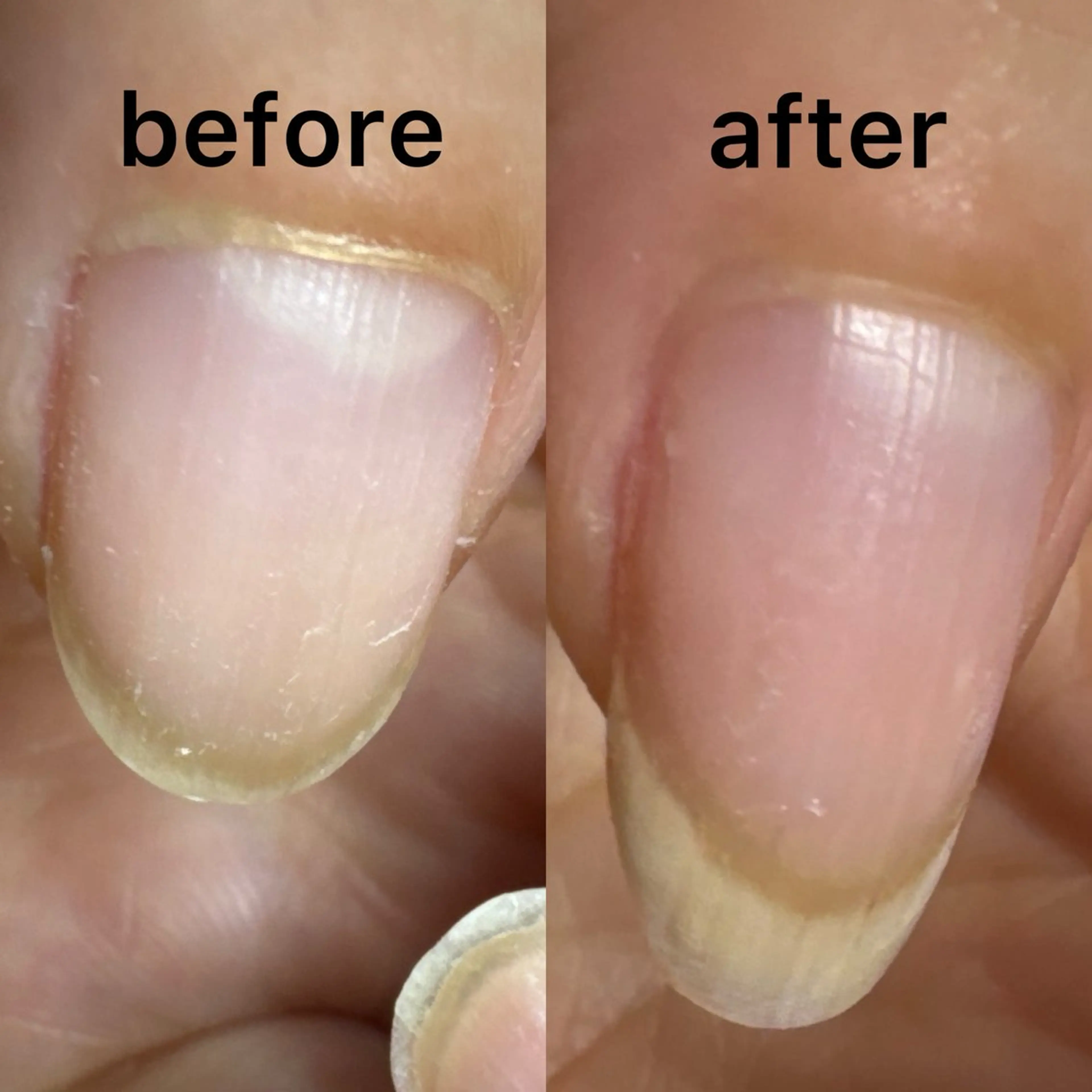 ネイル ジェルネイル ハンドネイル ハンドケア 岩田 久美子のネイルデザイン