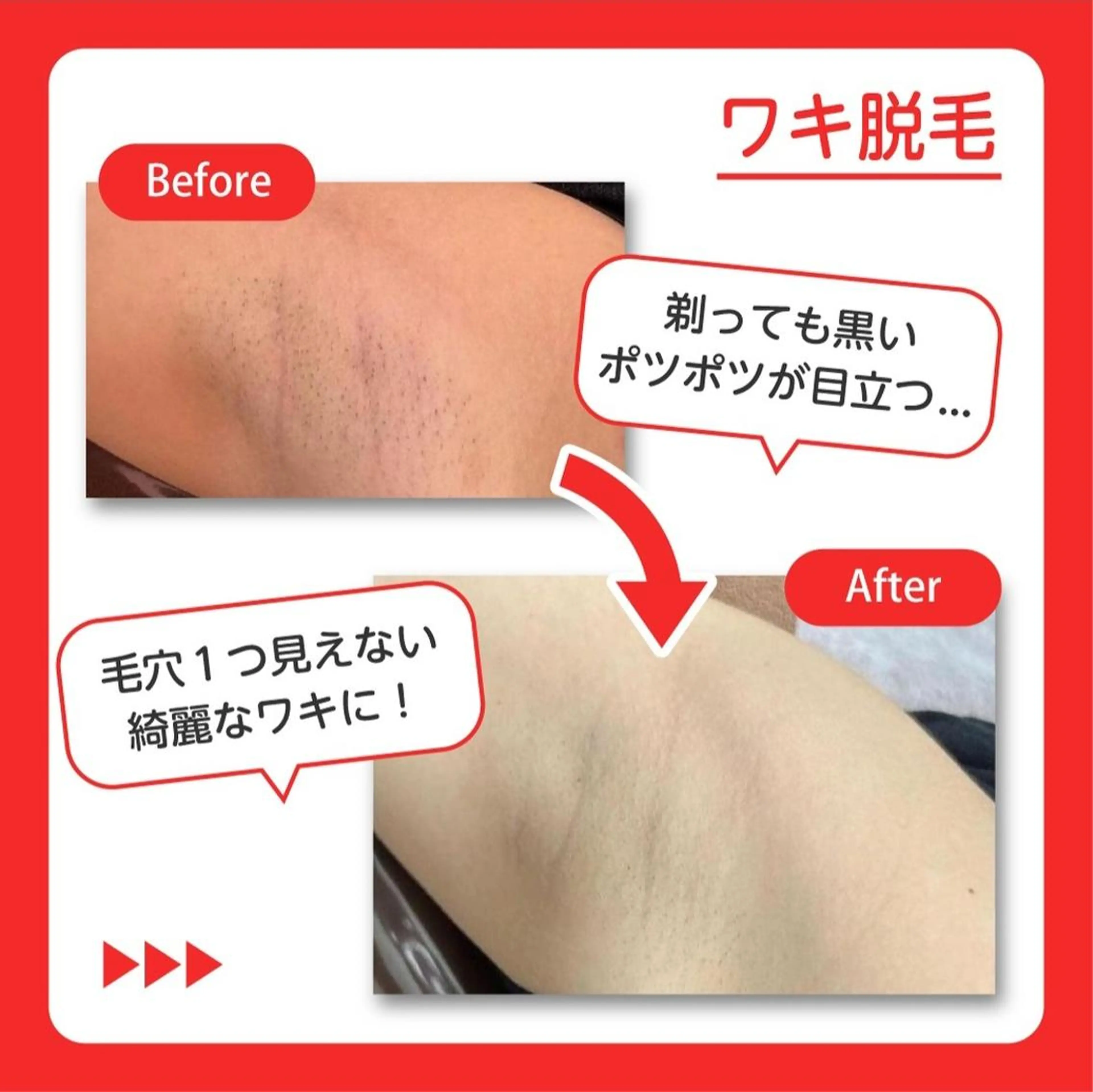 RinRin 松山店のエステ・リラクイメージ