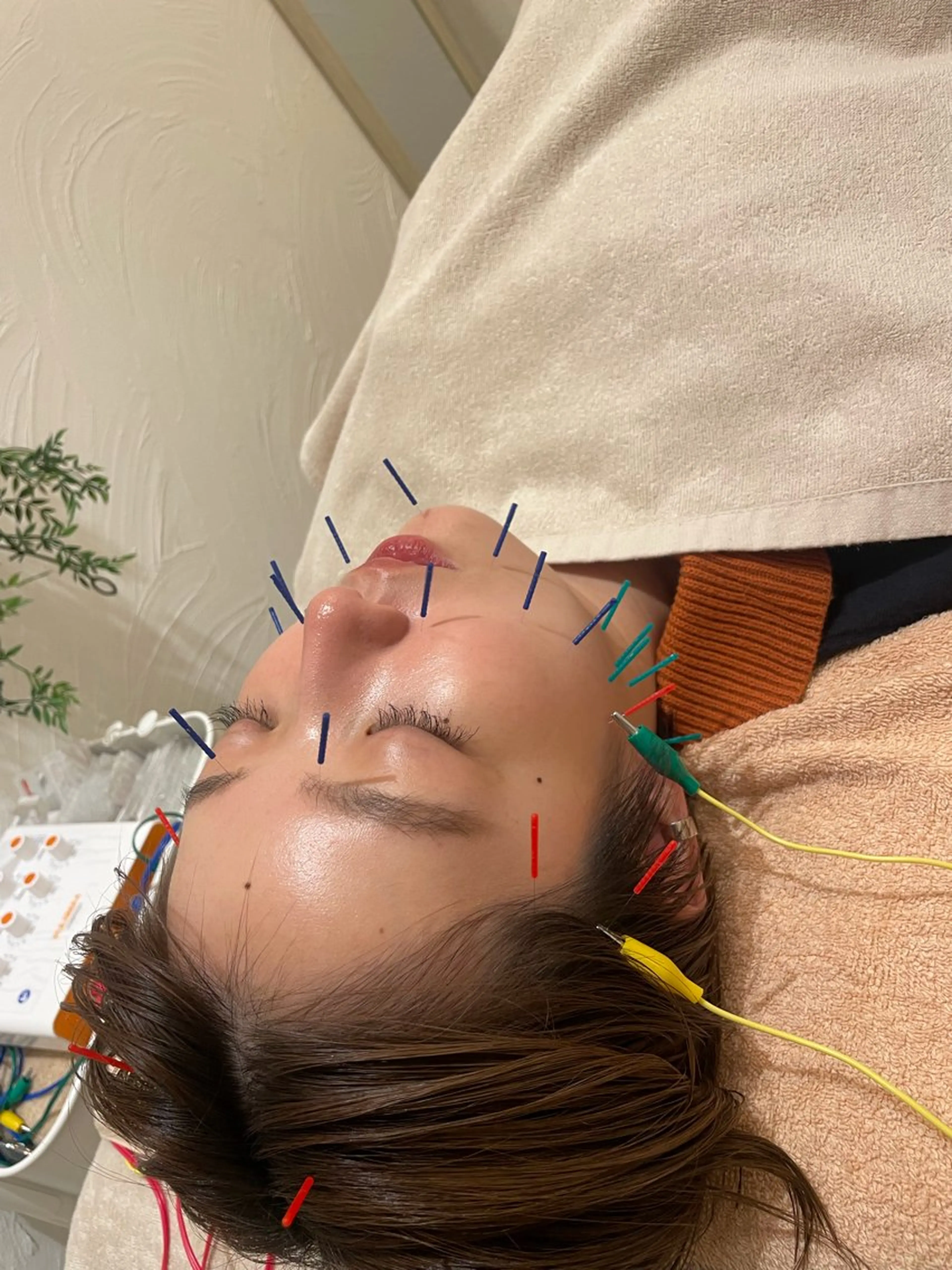 エステ リラク 🌸美容鍼サロン🌸 メゾンブランシェ🌈のエステ・リラクイメージ