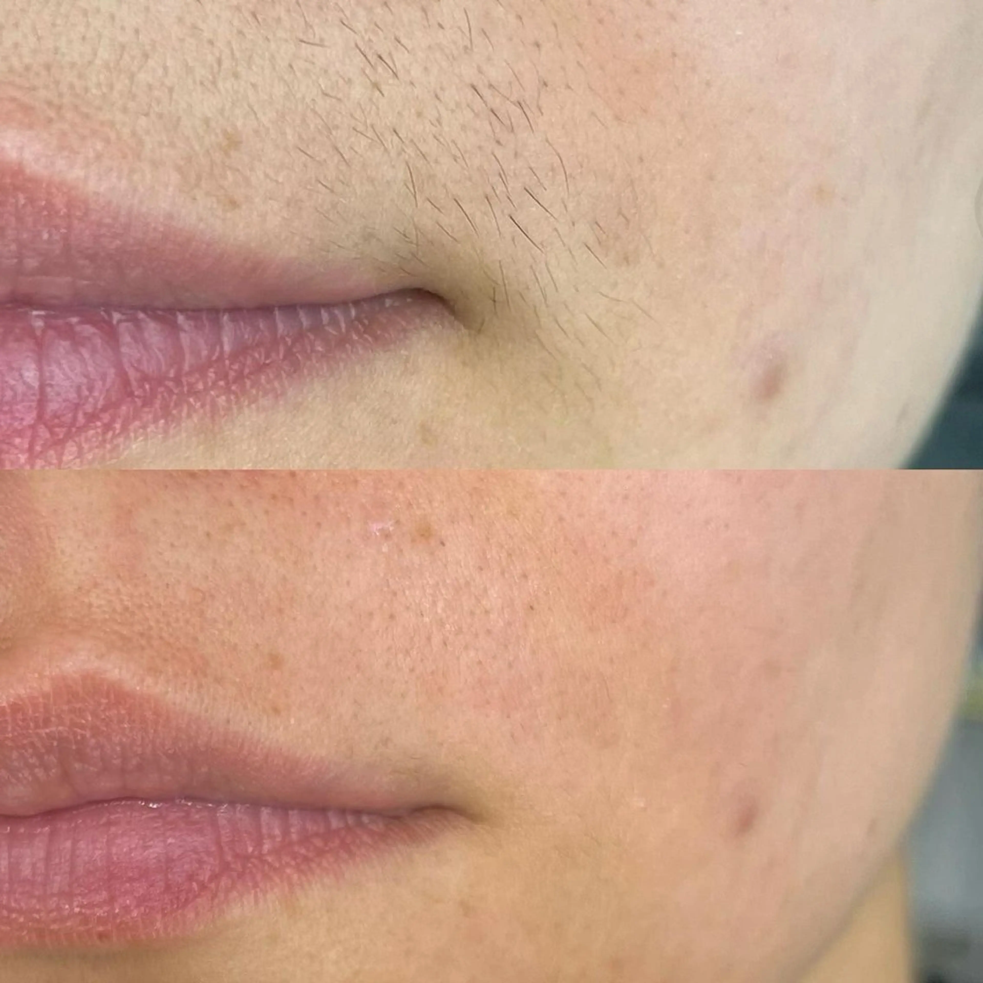 Lam..肌質改善 専門 女性専用サロンのエステ・リラクイメージ