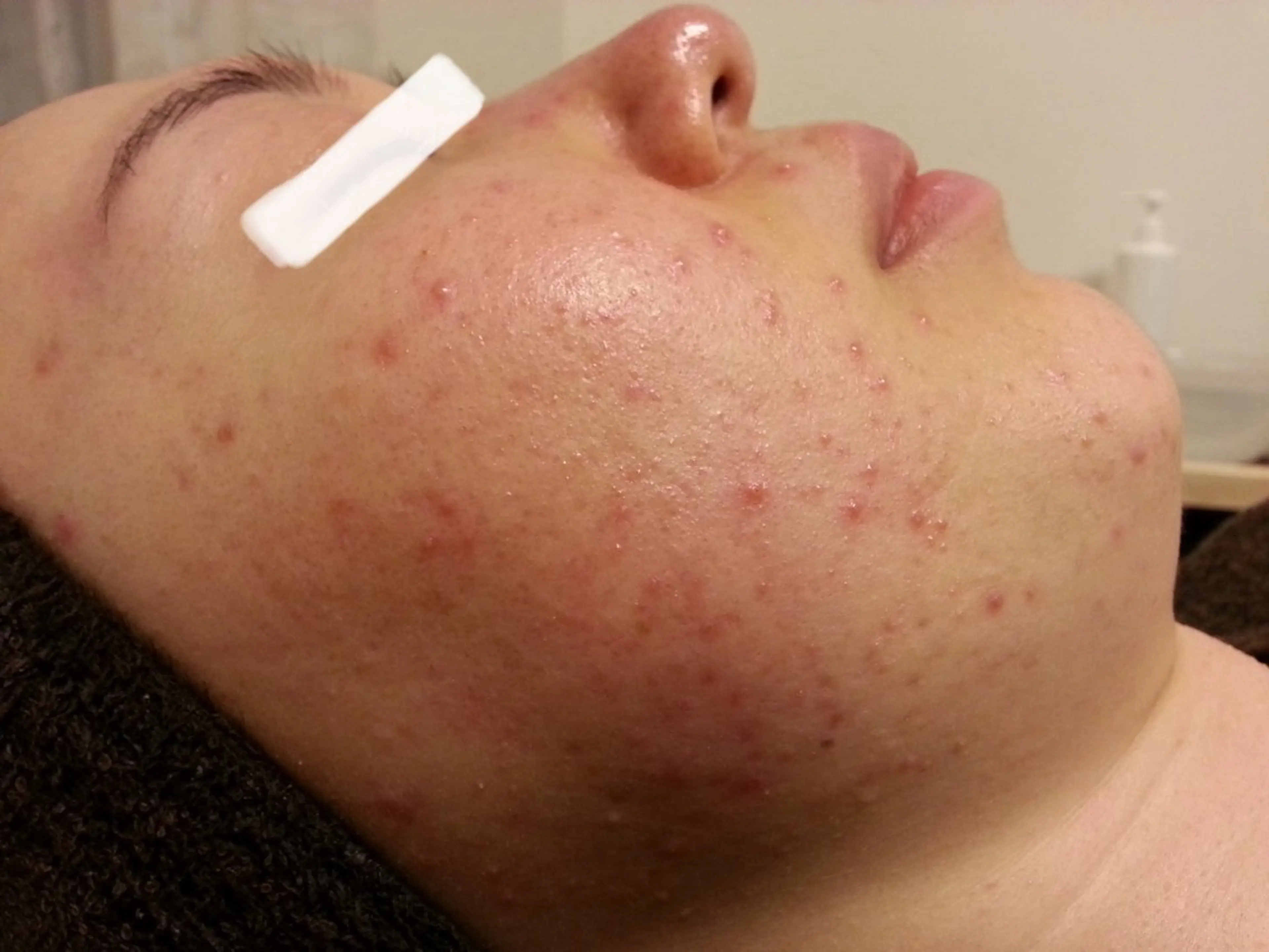 ピーリングサロン シャンテールのエステ・リラクイメージ